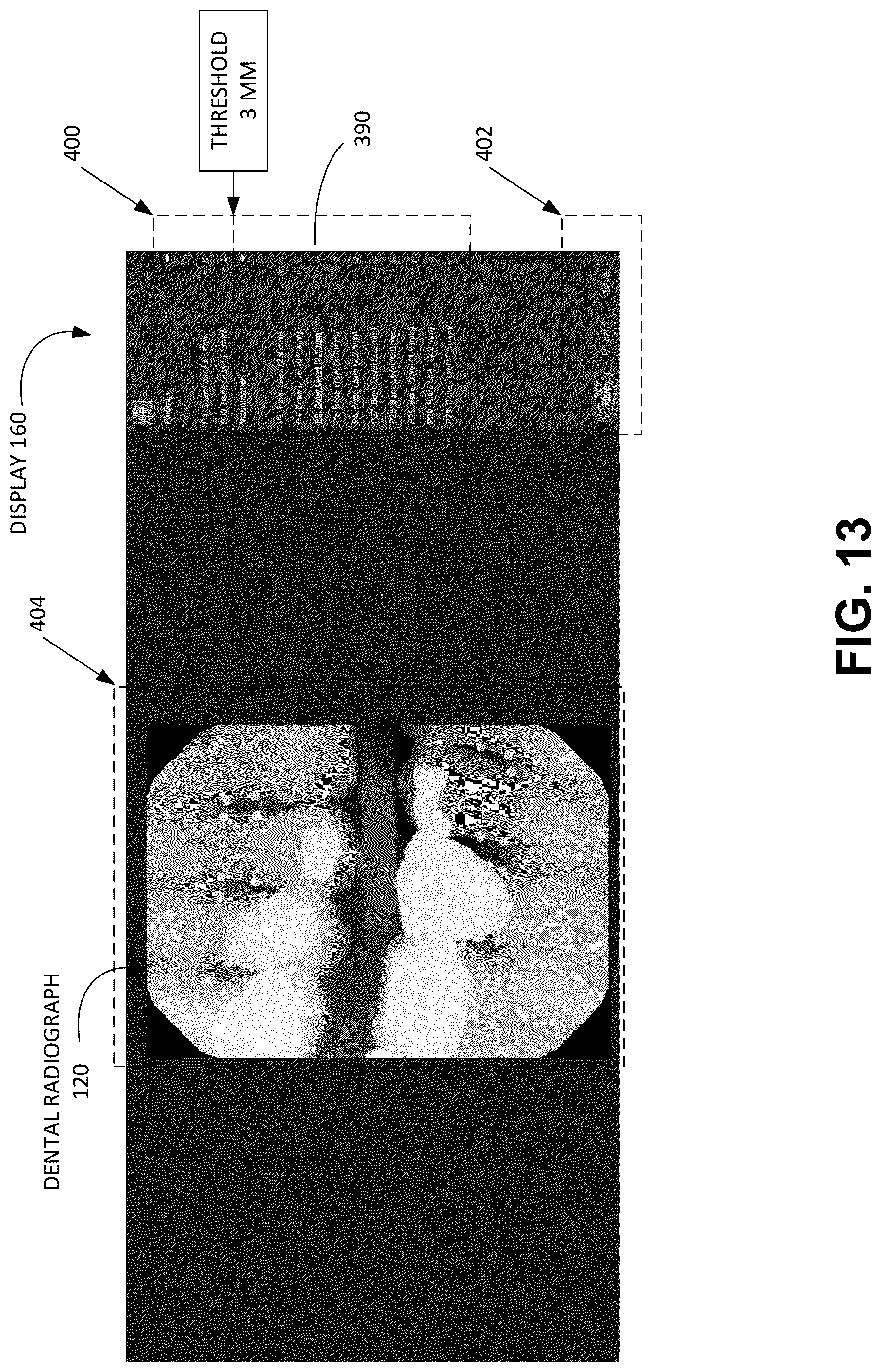 Patent US12106848 Figure 13 – Systems and methods for integrity analysis of clinical data