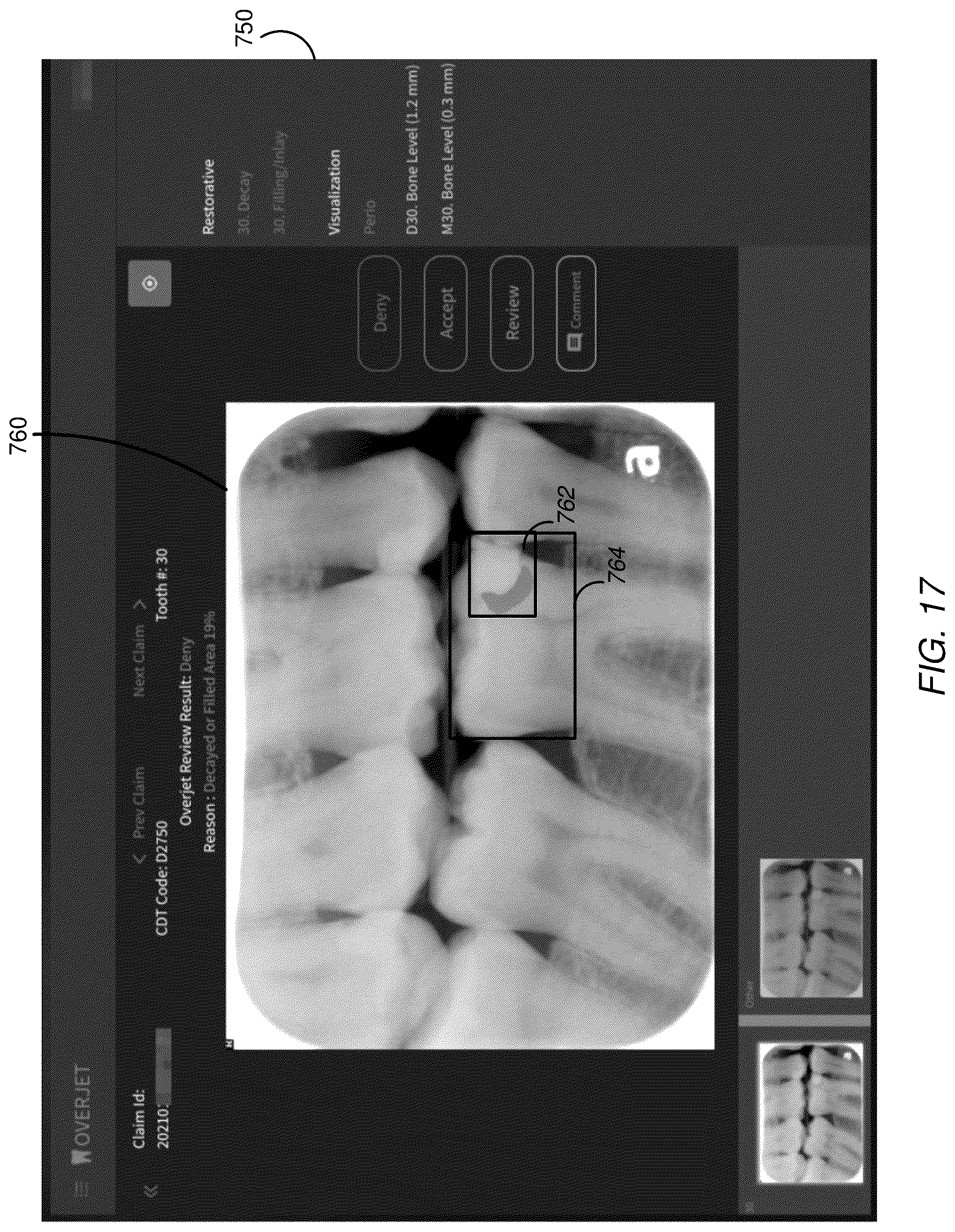 Patent US12106848 Figure 17 – Systems and methods for integrity analysis of clinical data