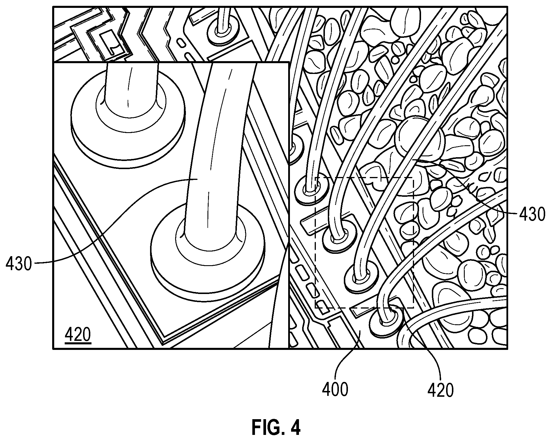 Patent US12106973 Figure 4 – Two-step decapsulation technique for semiconductor package having silver bond wires