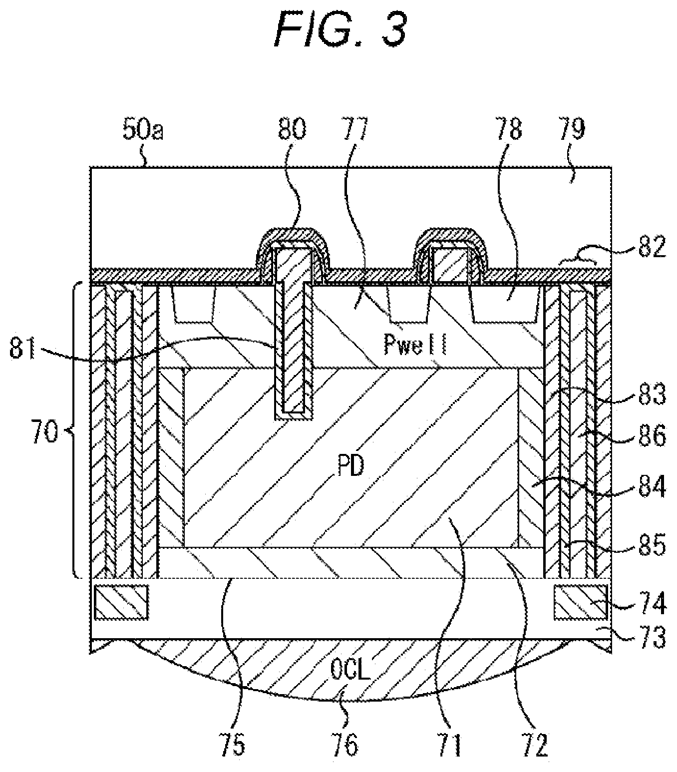 Patent US12107097 Figure 3 – Solid-state imaging device and electronic apparatus