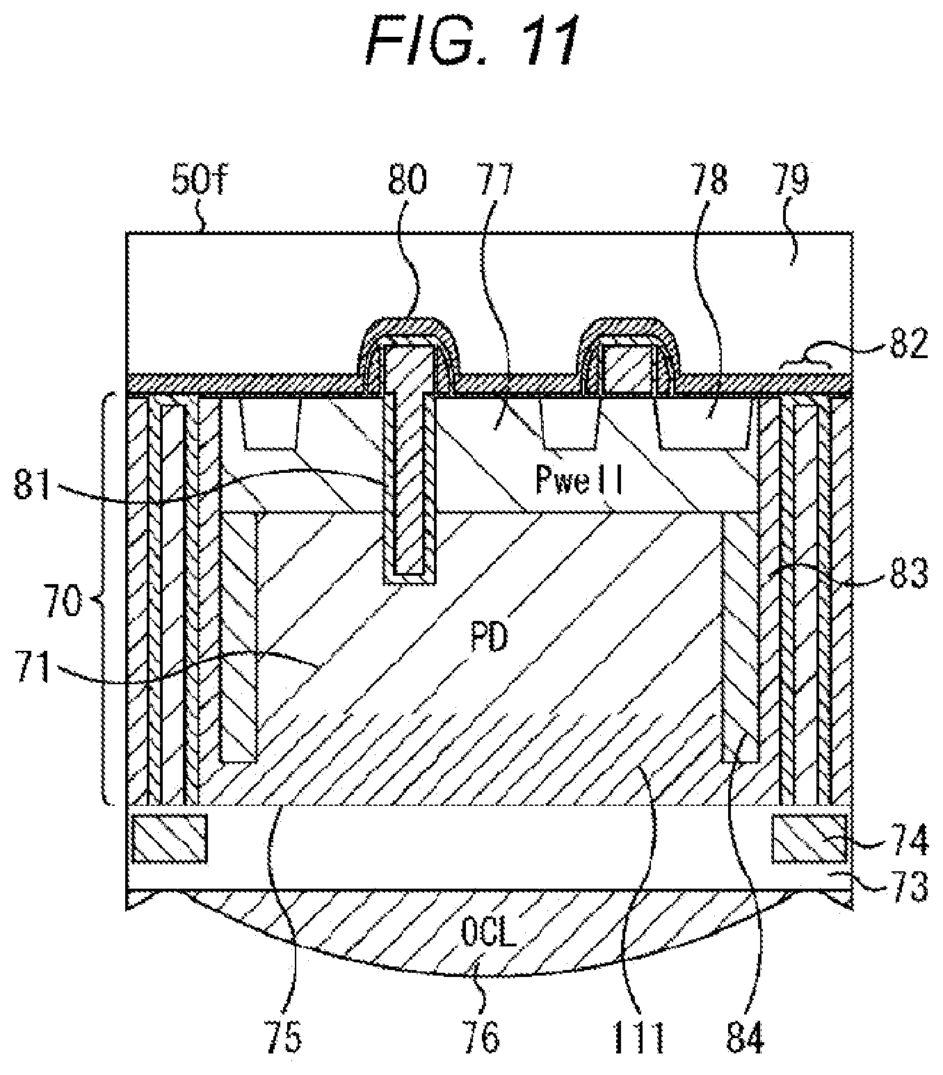 Patent US12107097 Figure 11 – Solid-state imaging device and electronic apparatus