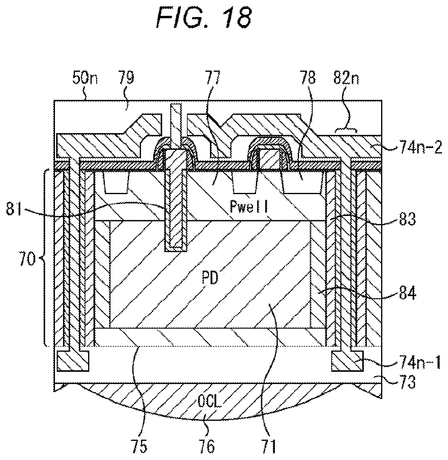 Patent US12107097 Figure 18 – Solid-state imaging device and electronic apparatus