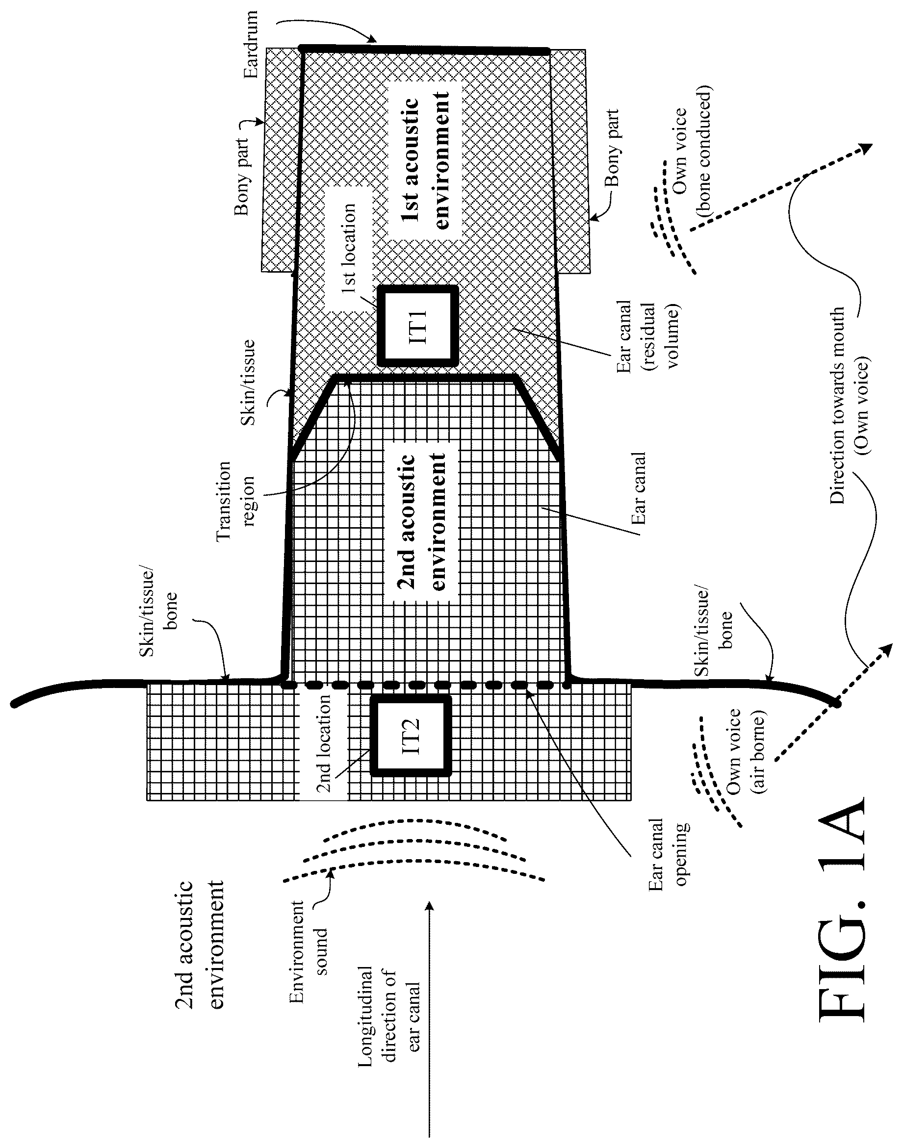 Patent US12108214 Figure 1 – Hearing device adapted to provide an estimate of a user's own voice