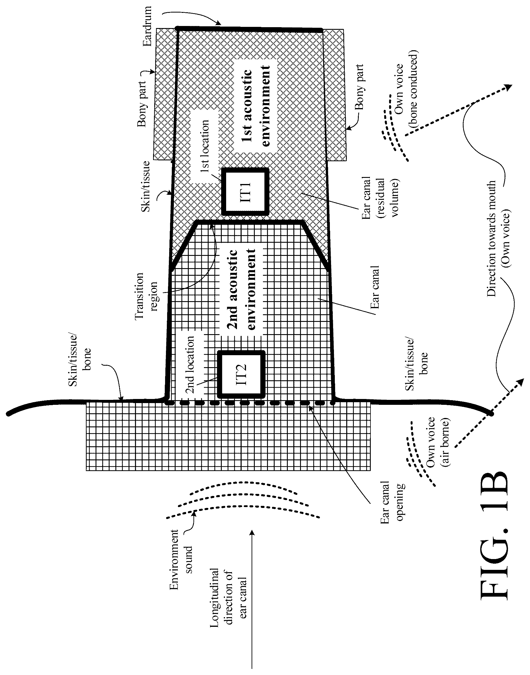 Patent US12108214 Figure 2 – Hearing device adapted to provide an estimate of a user's own voice