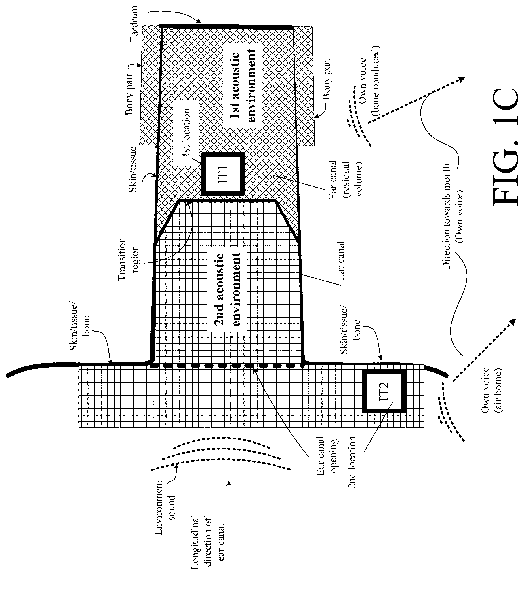 Patent US12108214 Figure 3 – Hearing device adapted to provide an estimate of a user's own voice