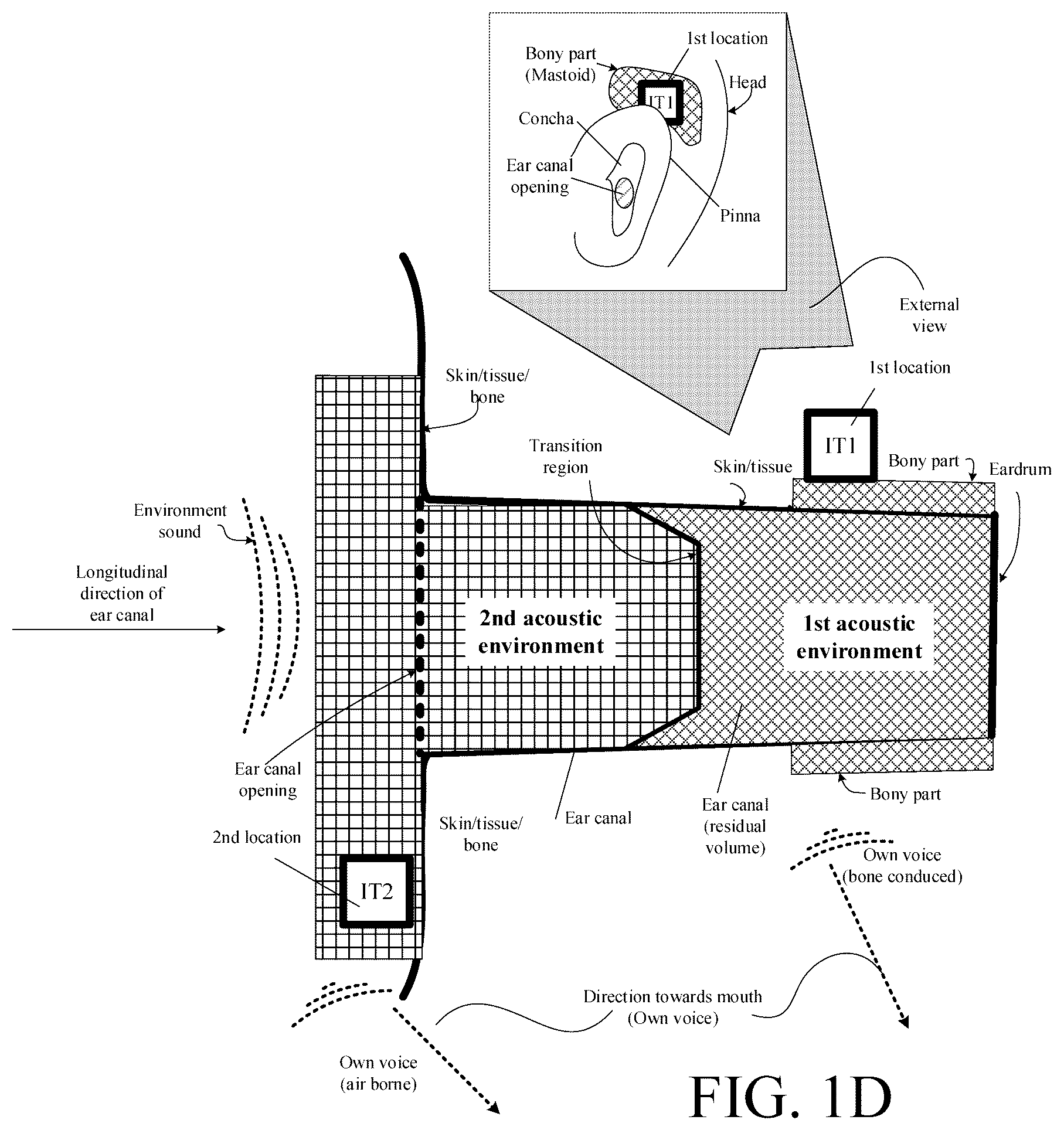 Patent US12108214 Figure 4 – Hearing device adapted to provide an estimate of a user's own voice