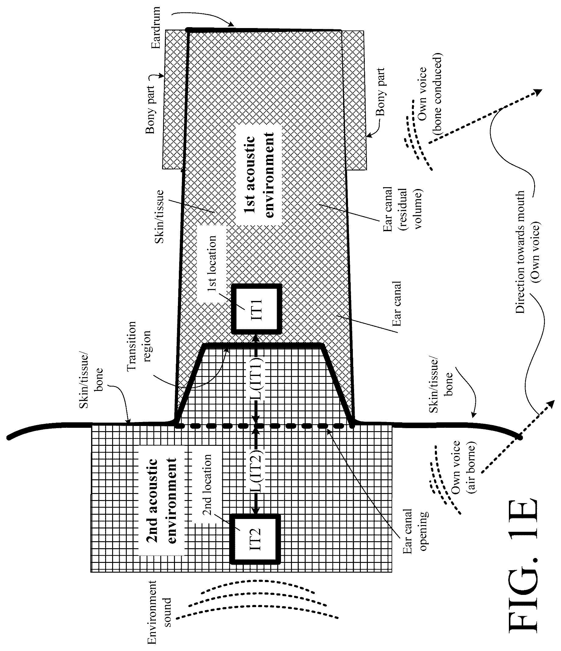Patent US12108214 Figure 5 – Hearing device adapted to provide an estimate of a user's own voice