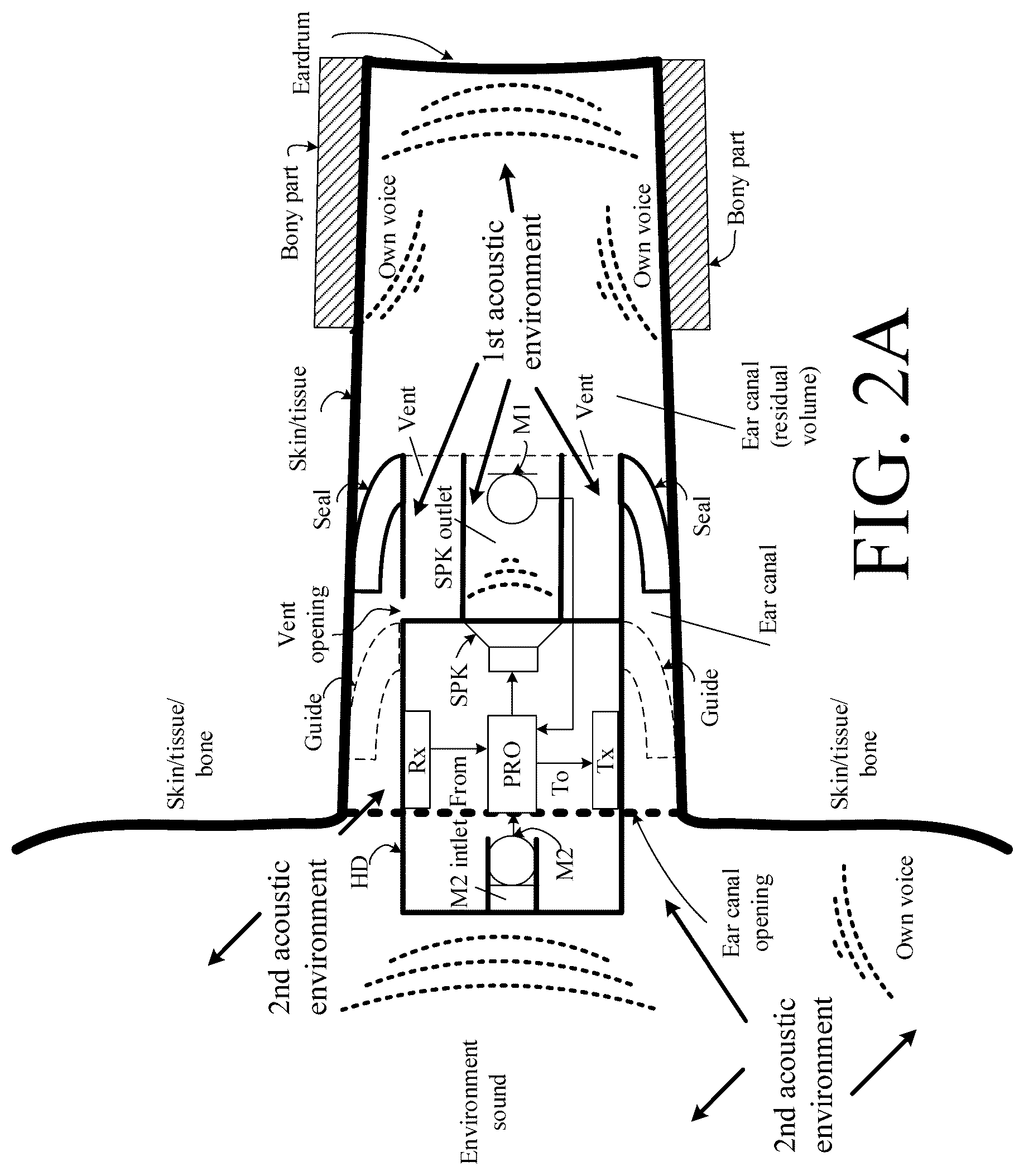Patent US12108214 Figure 6 – Hearing device adapted to provide an estimate of a user's own voice