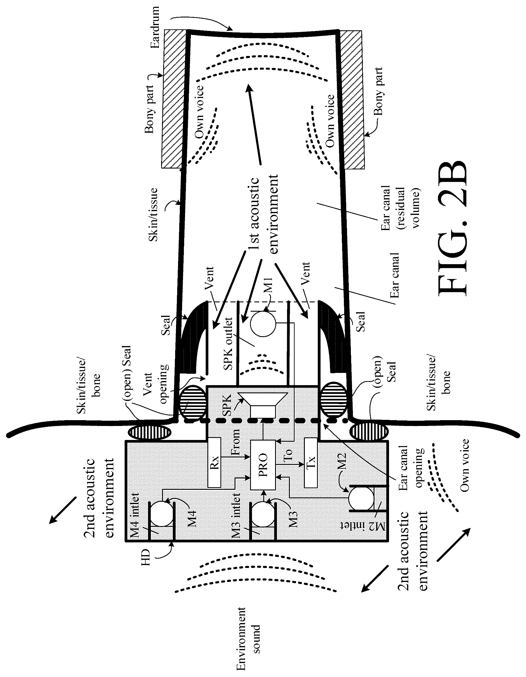Patent US12108214 Figure 7 – Hearing device adapted to provide an estimate of a user's own voice