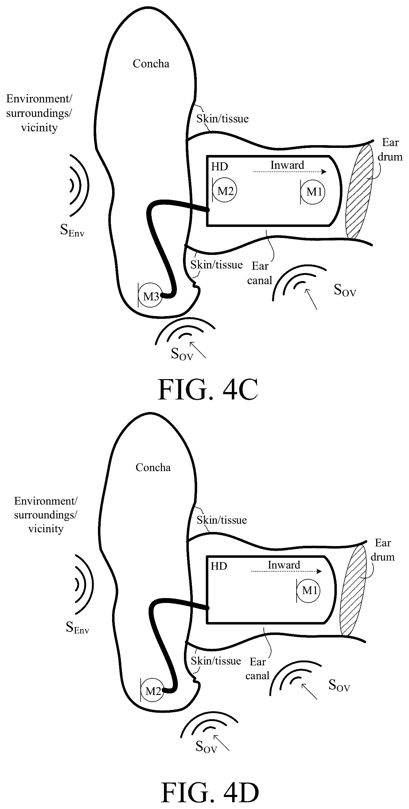 Patent US12108214 Figure 10 – Hearing device adapted to provide an estimate of a user's own voice
