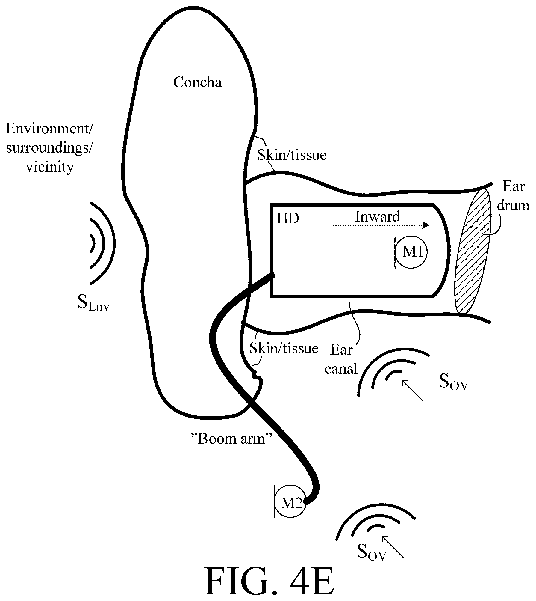 Patent US12108214 Figure 11 – Hearing device adapted to provide an estimate of a user's own voice