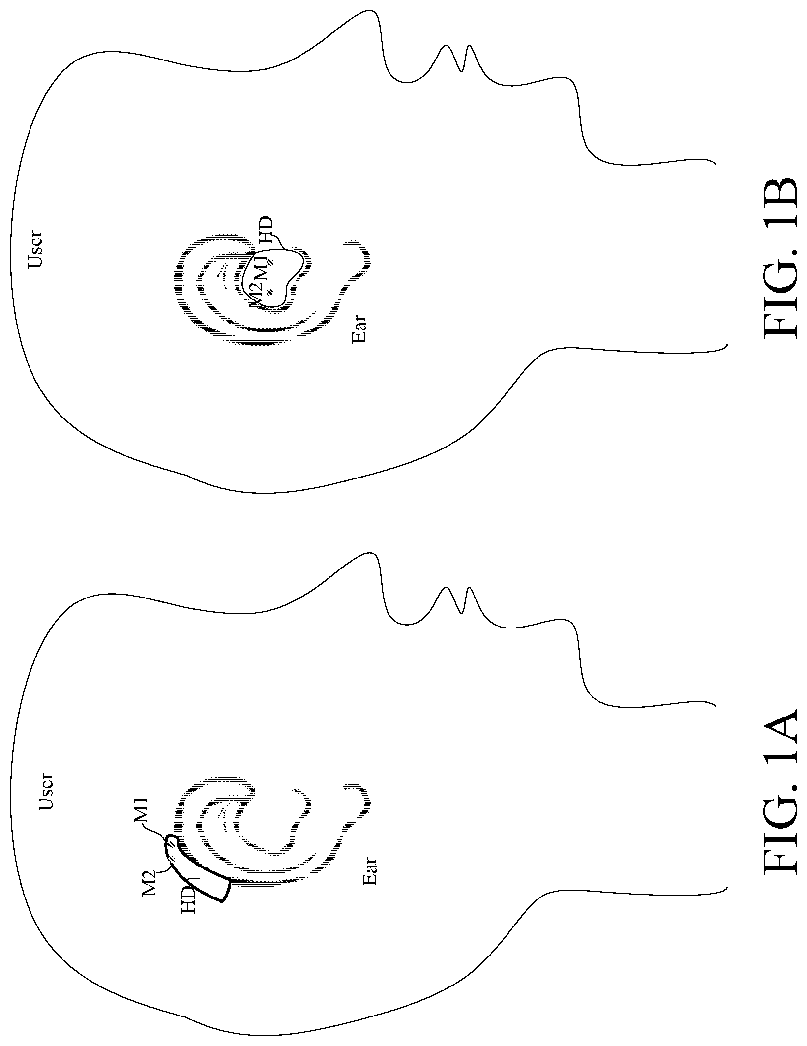 Patent US12108215 Figure 1 – Hearing aid configured to select a reference microphone