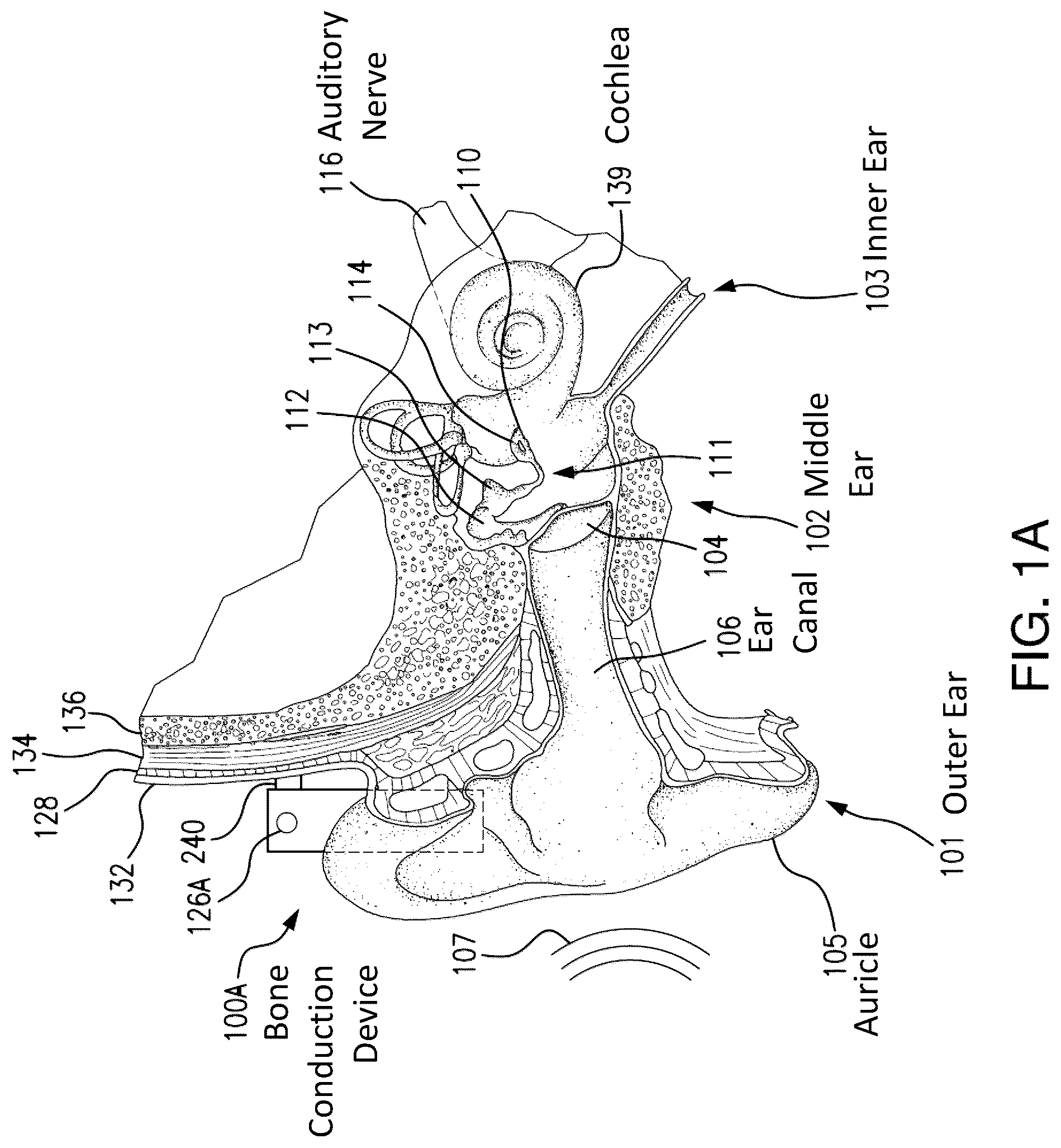 Patent US12108216 Figure 1 – Impact and resonance management