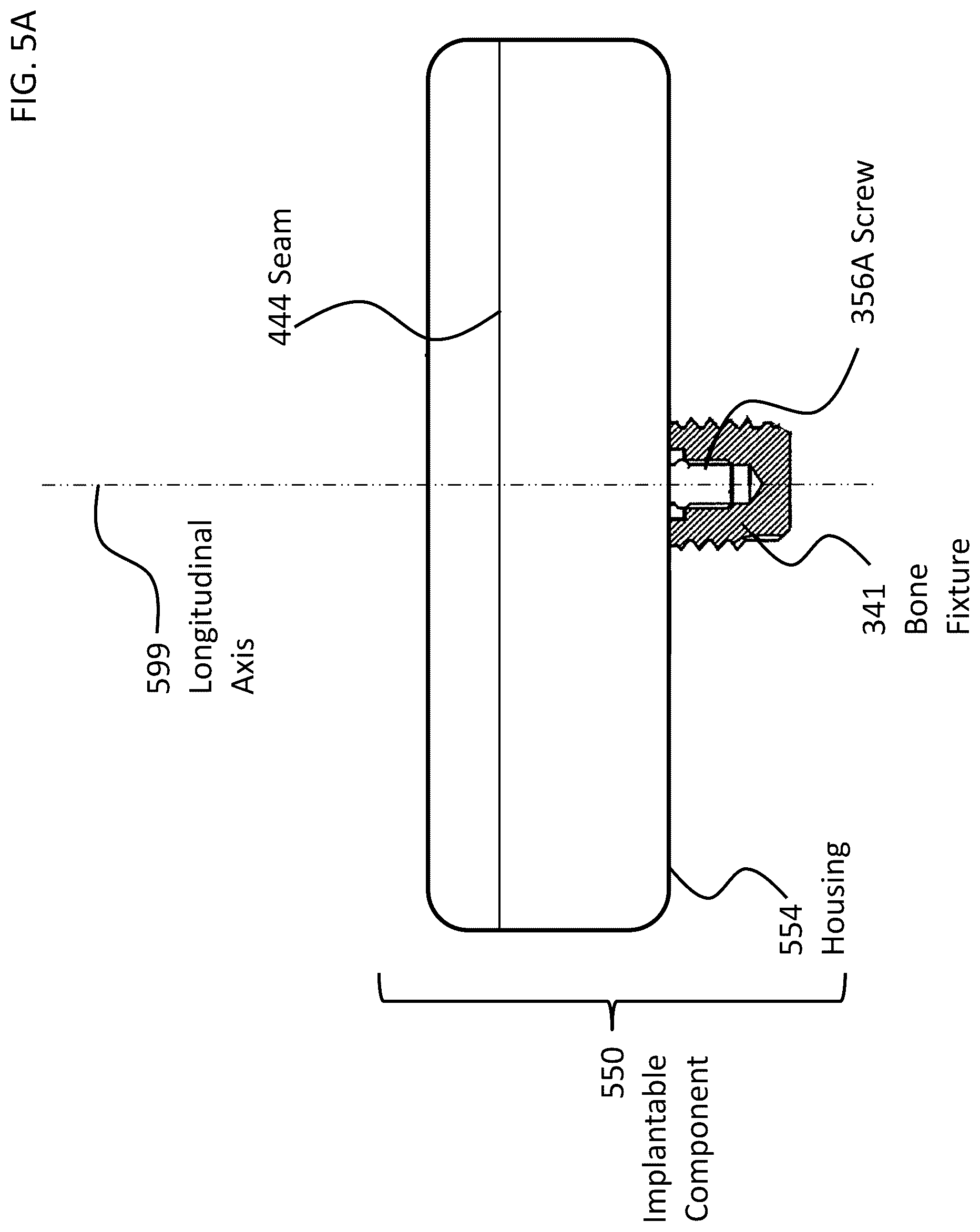 Patent US12108216 Figure 6 – Impact and resonance management