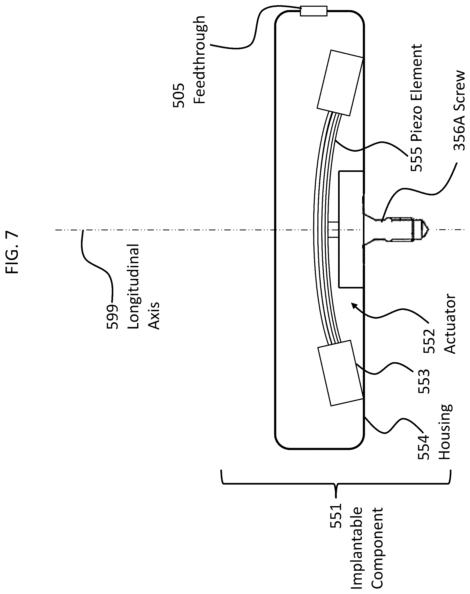 Patent US12108216 Figure 9 – Impact and resonance management