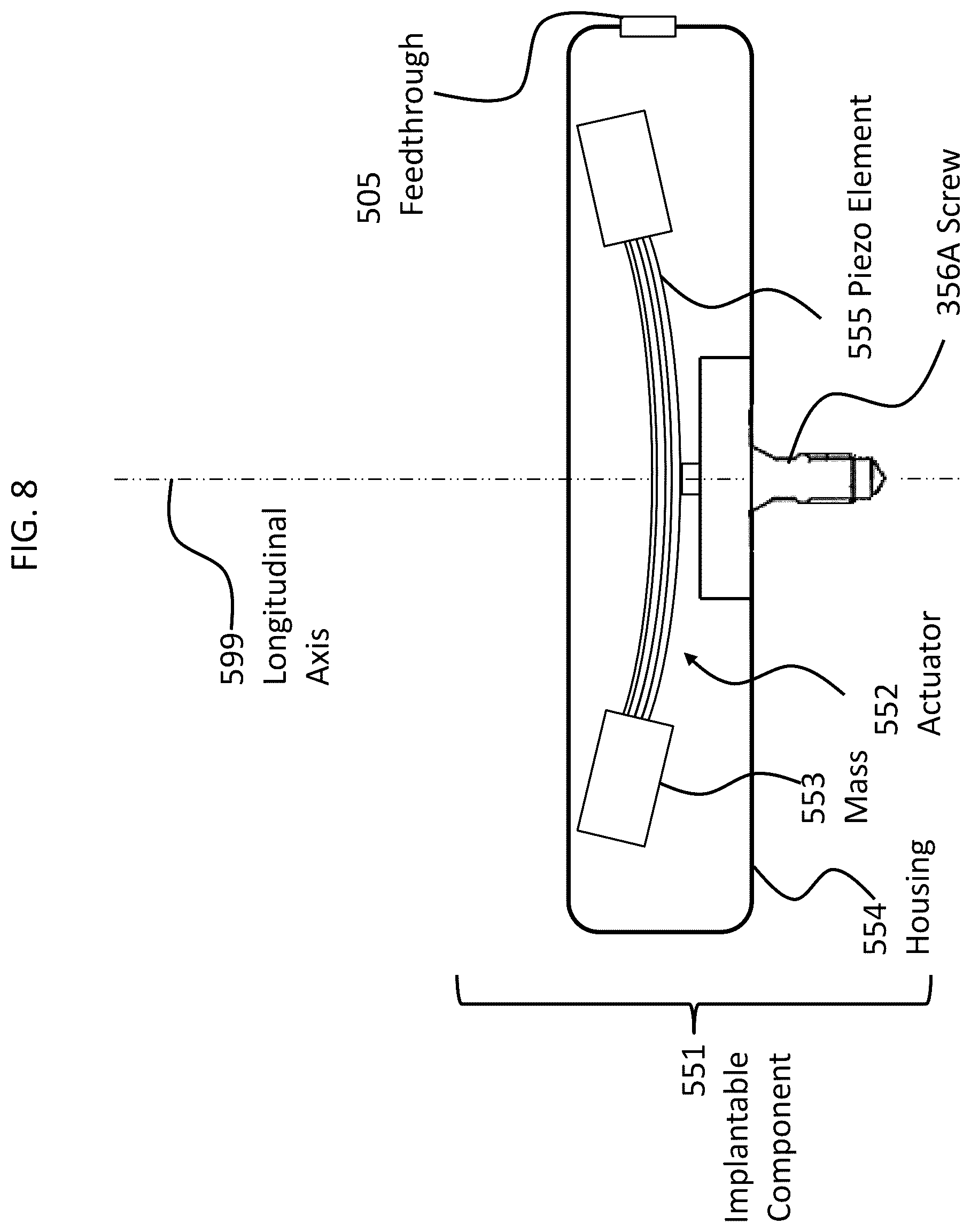 Patent US12108216 Figure 10 – Impact and resonance management
