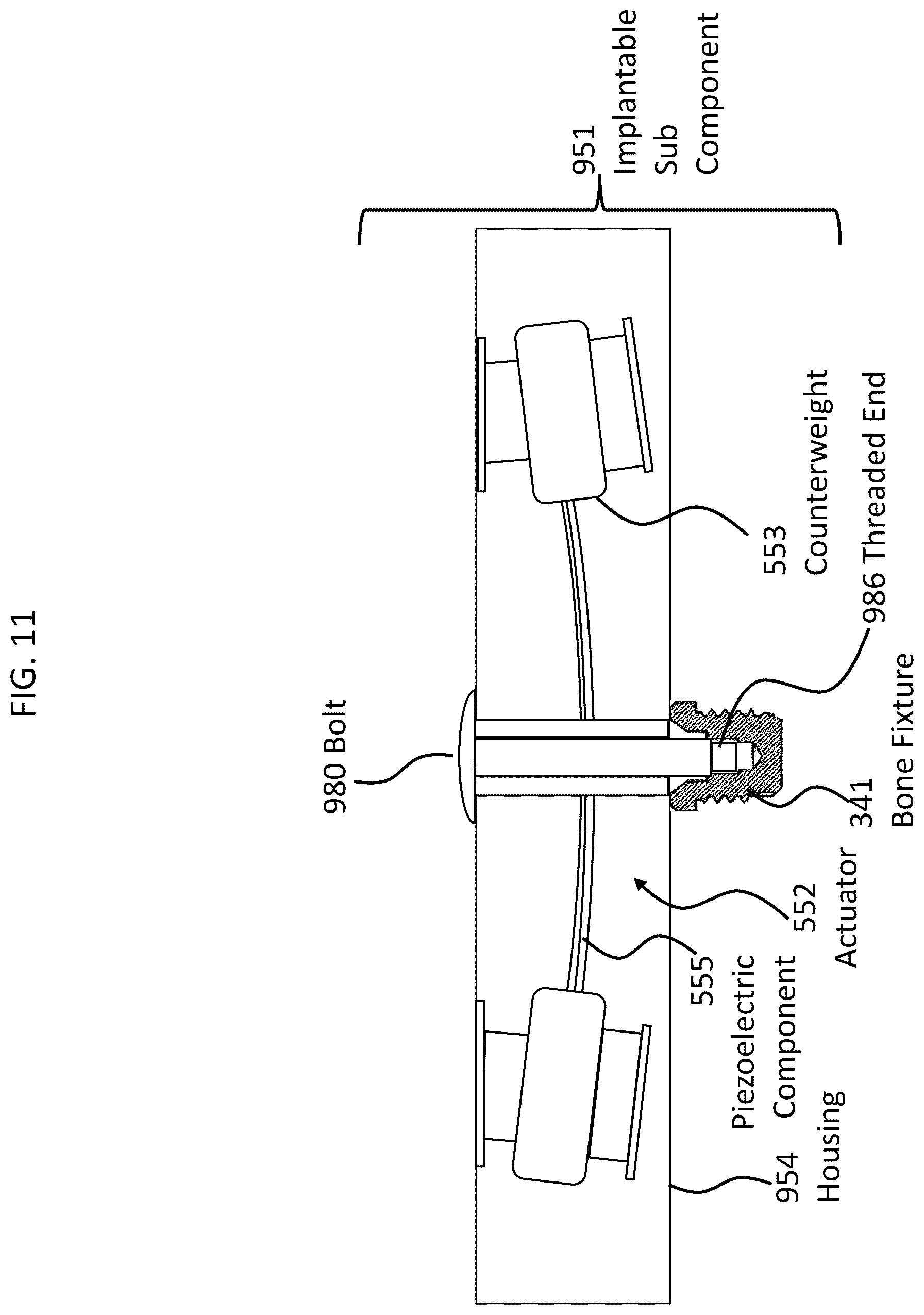 Patent US12108216 Figure 17 – Impact and resonance management