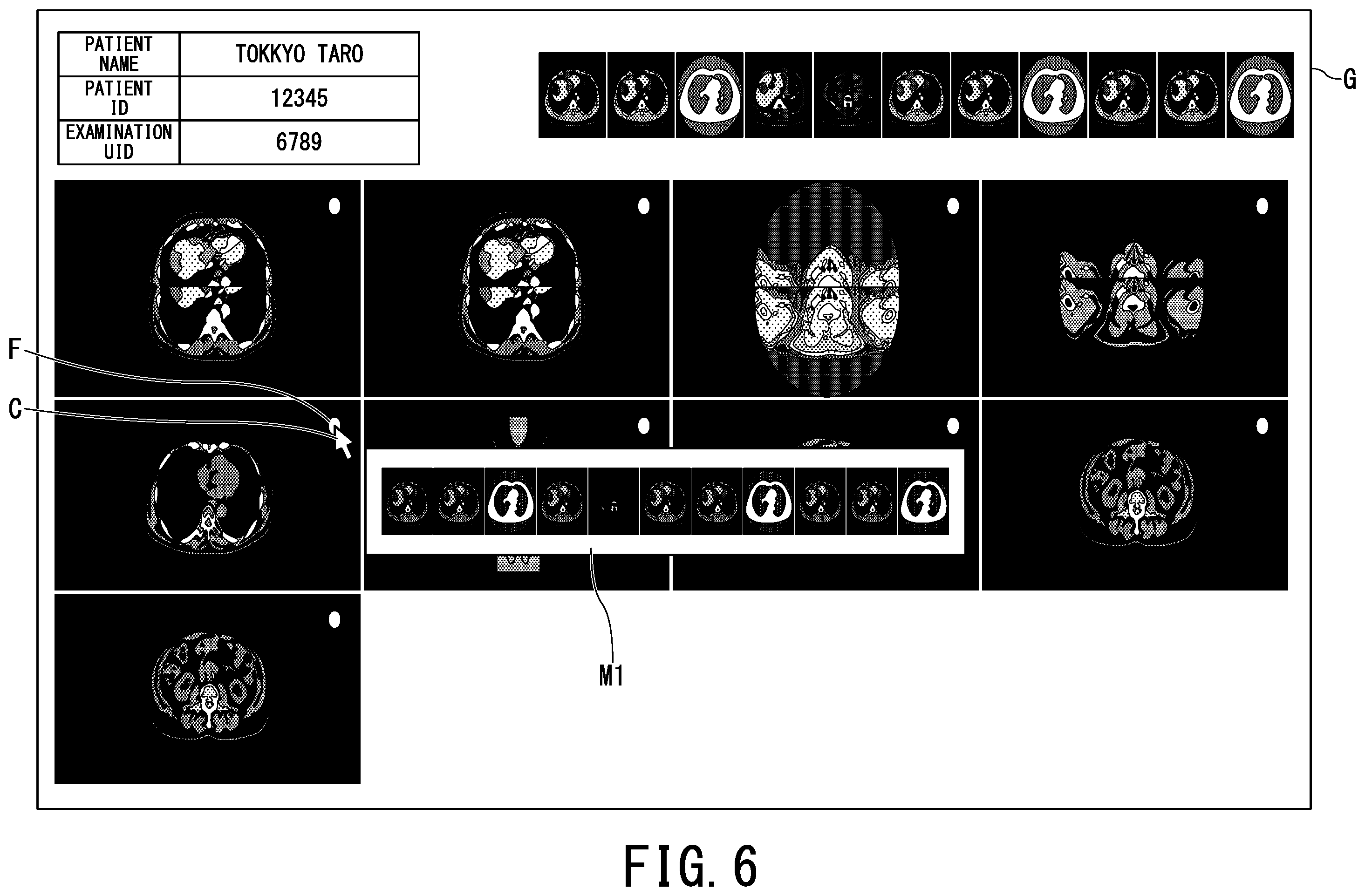 Patent US12112403 Figure 5 – Medical image display apparatus and medical image display system