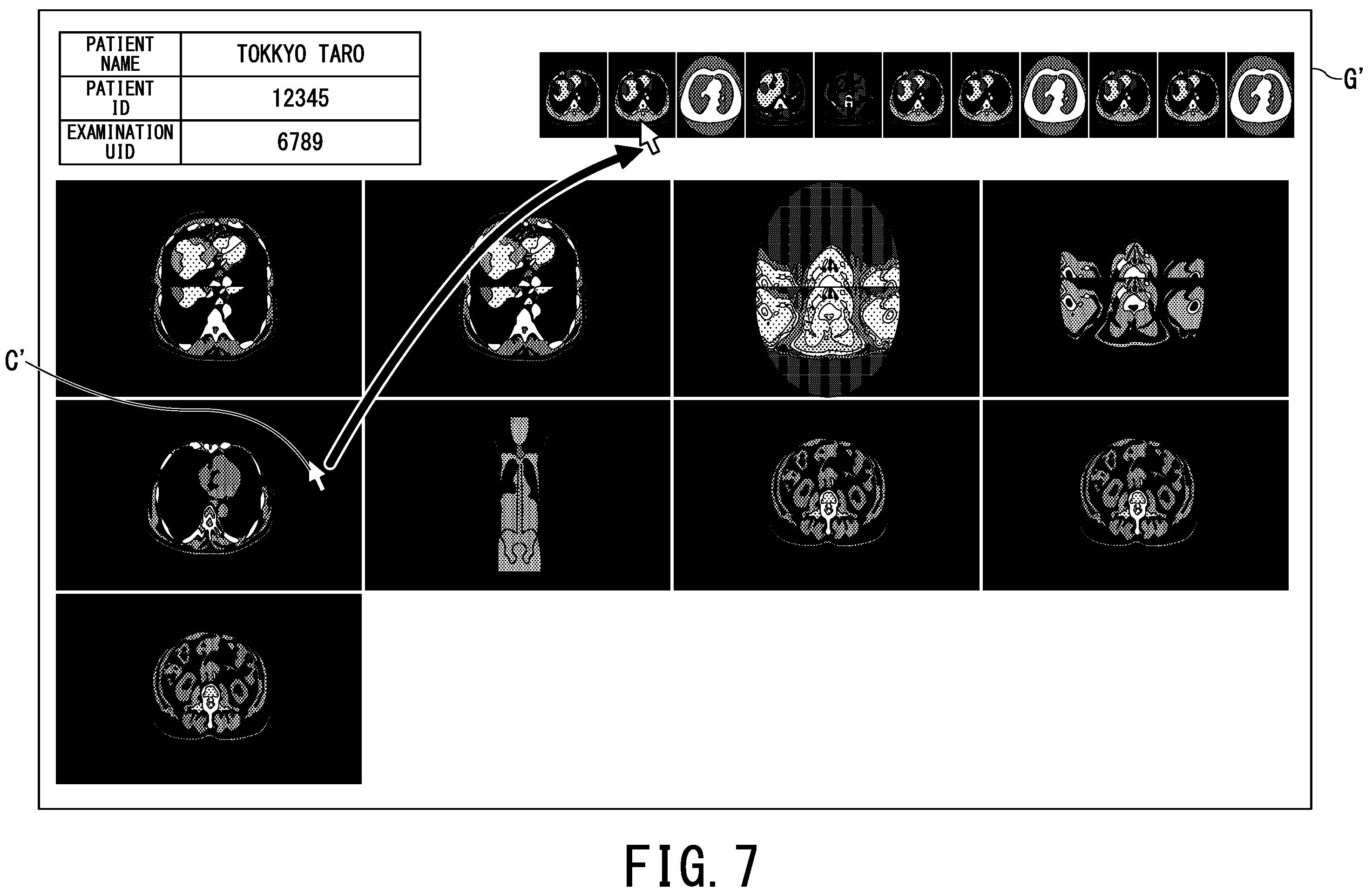 Patent US12112403 Figure 6 – Medical image display apparatus and medical image display system