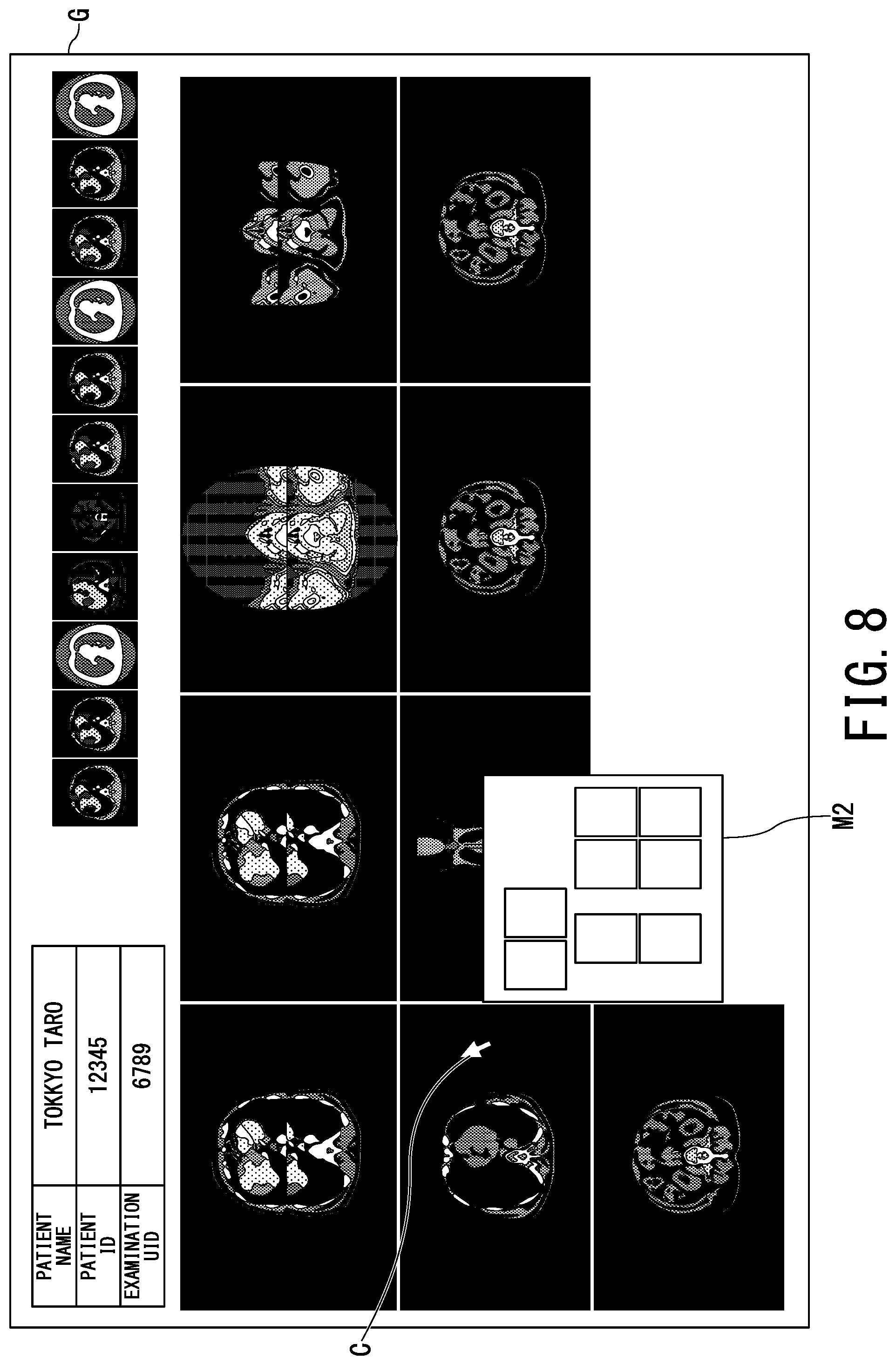 Patent US12112403 Figure 7 – Medical image display apparatus and medical image display system