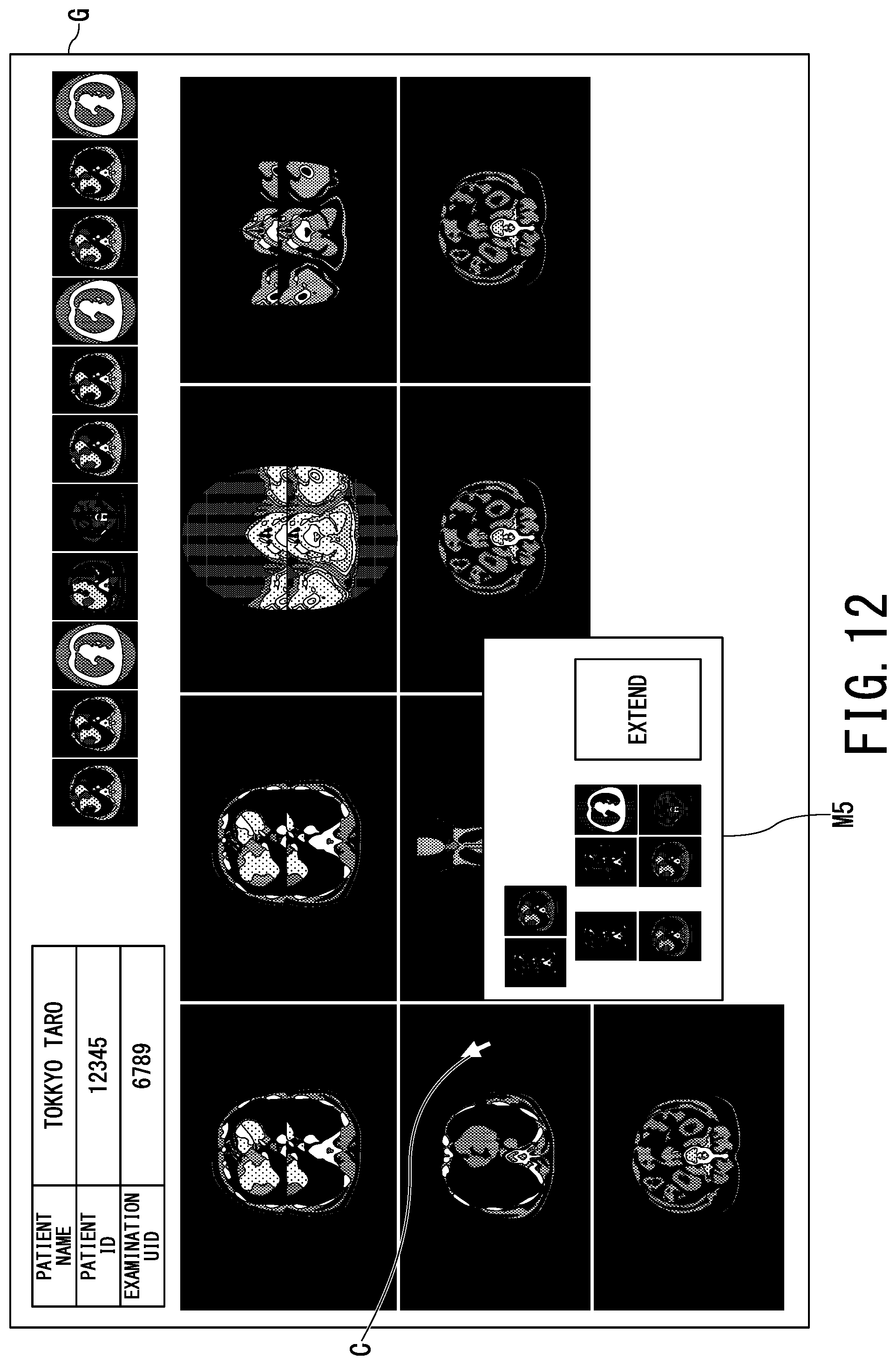 Patent US12112403 Figure 11 – Medical image display apparatus and medical image display system