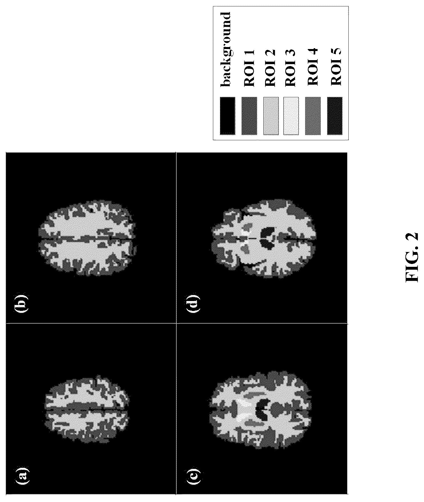 Patent US12112406 Figure 2 – Attention mechanism-based low-dose dual-tracer PET reconstruction method