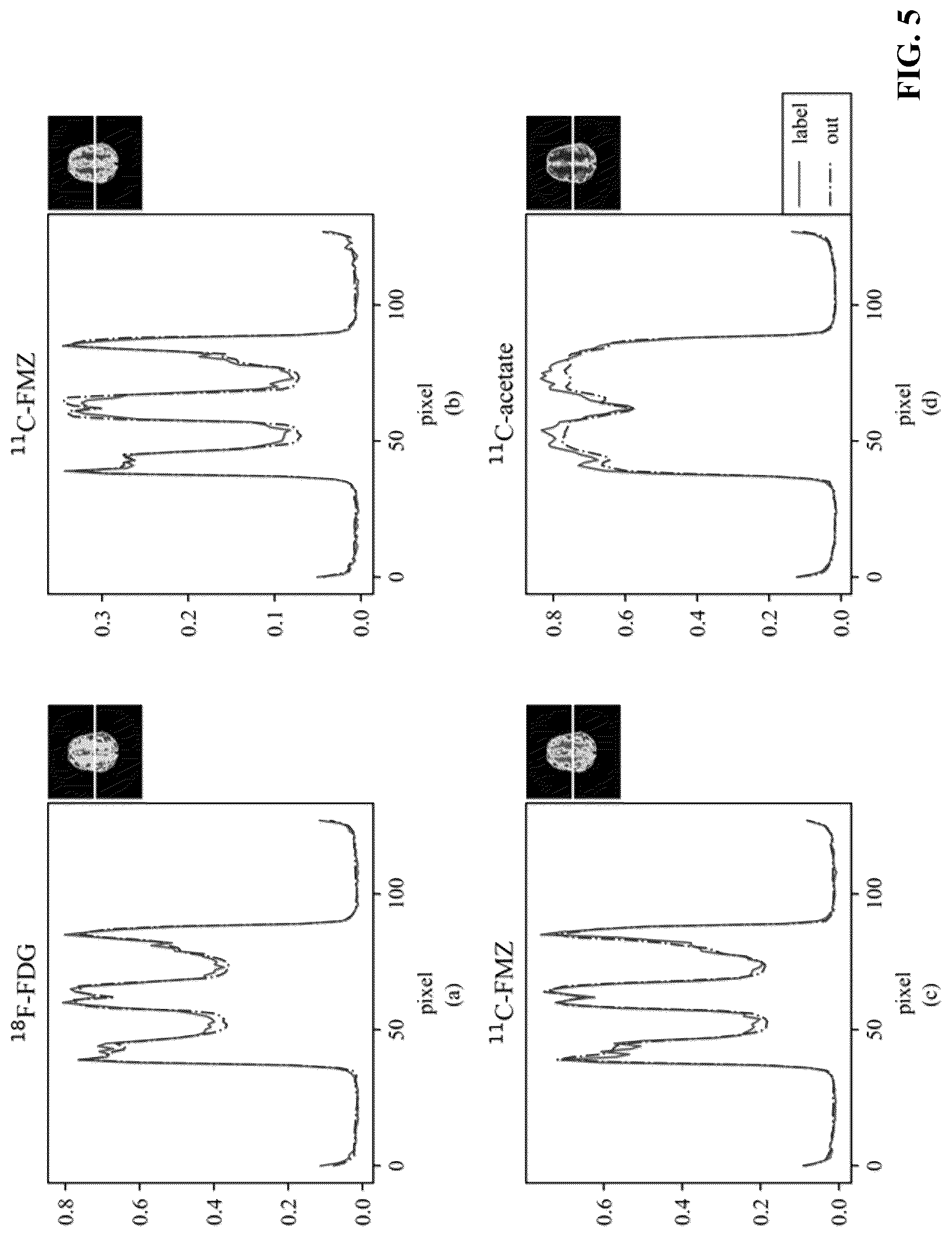 Patent US12112406 Figure 5 – Attention mechanism-based low-dose dual-tracer PET reconstruction method