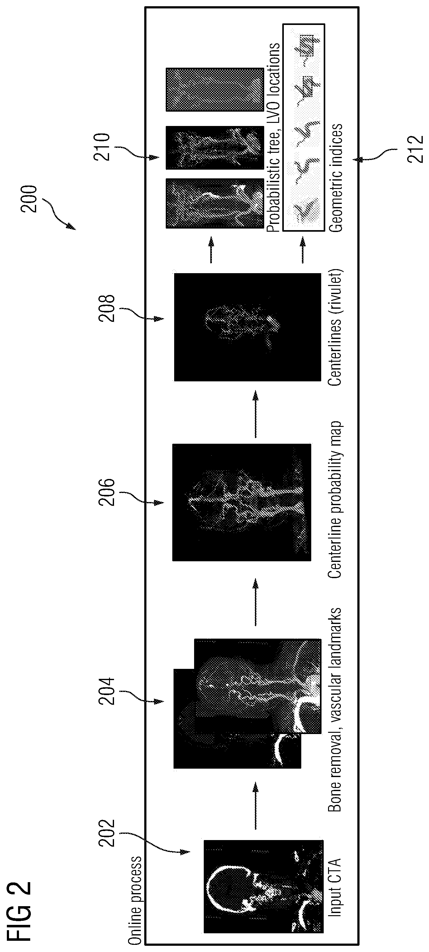 Patent US12112470 Figure 2 – Probabilistic tree tracing and large vessel occlusion detection in medical imaging