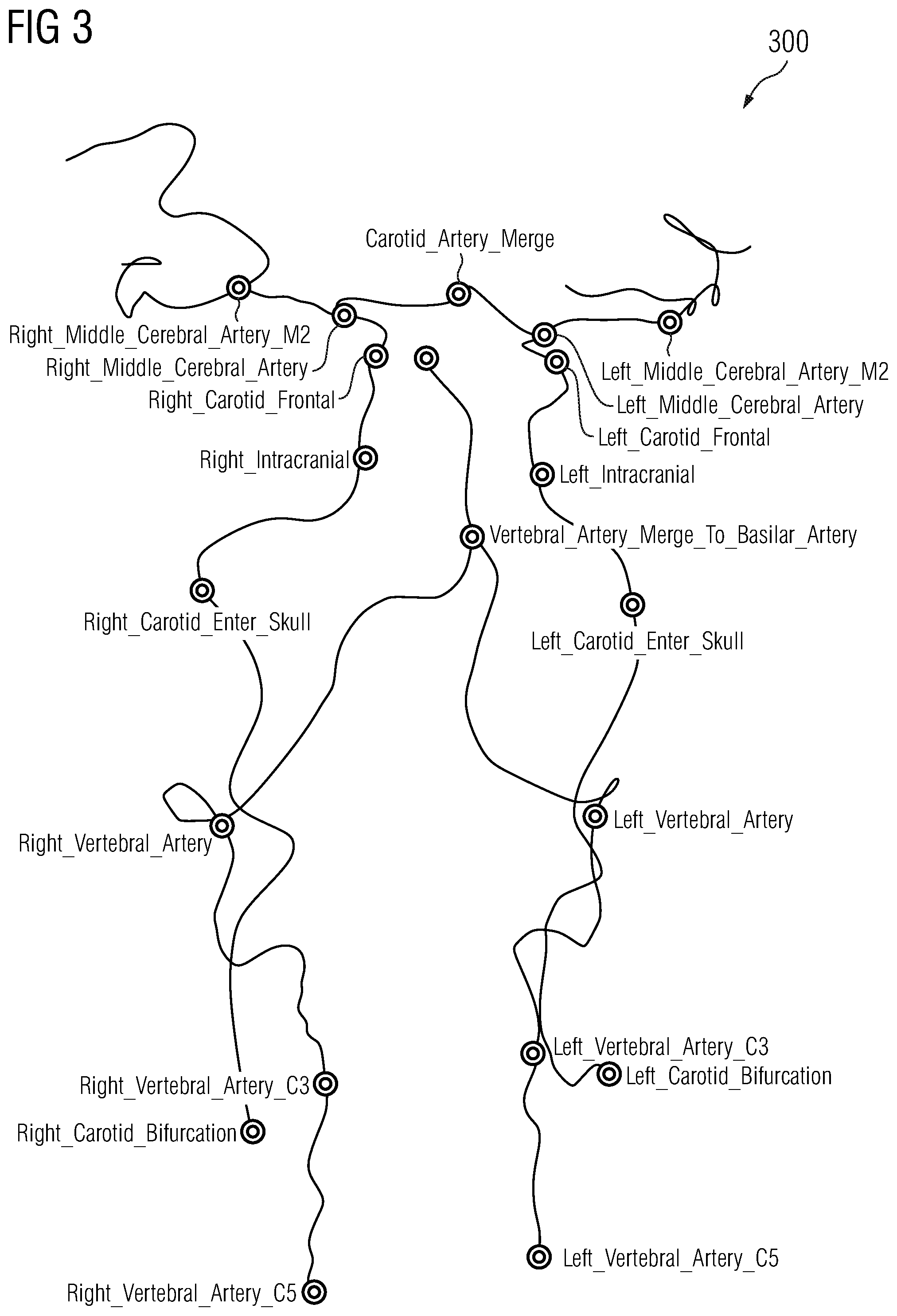 Patent US12112470 Figure 3 – Probabilistic tree tracing and large vessel occlusion detection in medical imaging