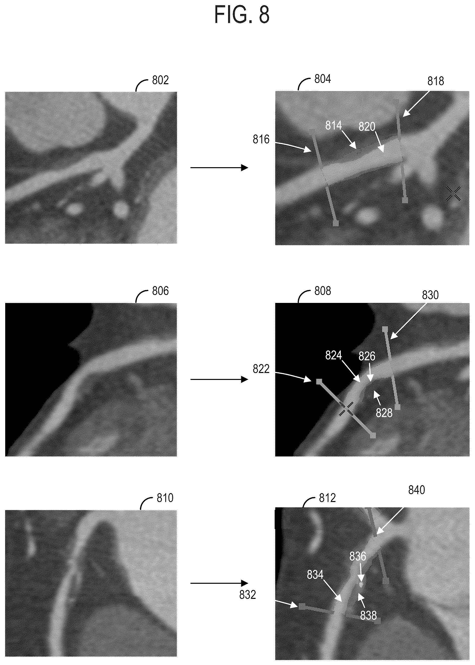 Patent US12112471 Figure 7 – Systems and methods for multi-label segmentation of cardiac computed tomography and angiography images using deep neural networks