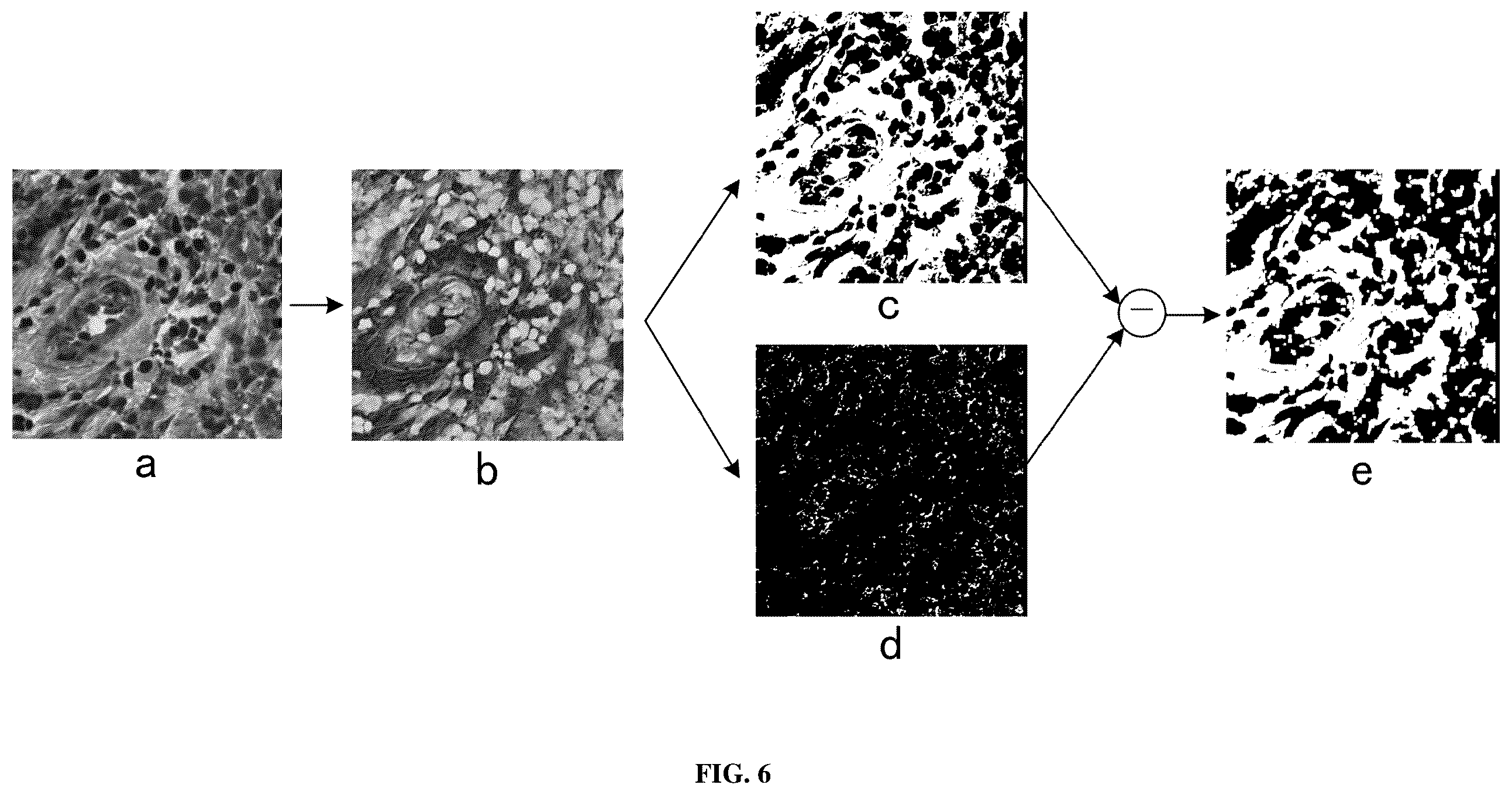 Patent US12112475 Figure 4 – Method and system for predicting tumor mutation burden (TMB) in triple negative breast cancer (TNBC) based on nuclear scores and histopathological whole slide images (WSIs)