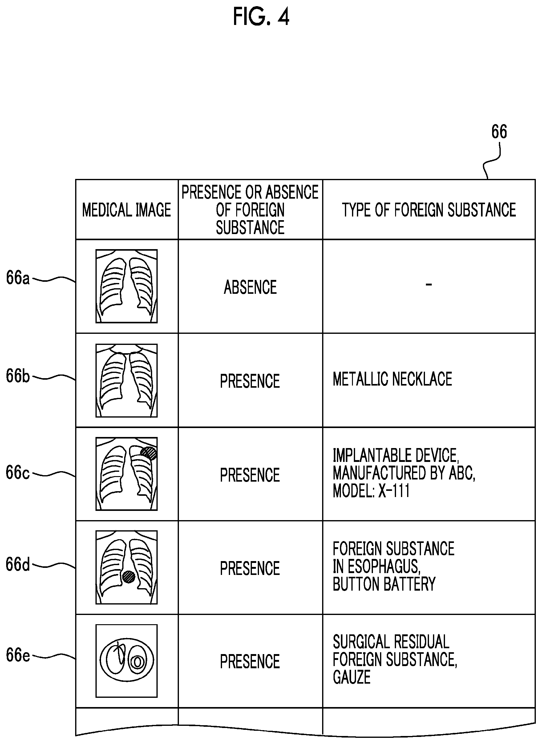 Patent US12112476 Figure 4 – Medical support device, operation method of medical support device, non-transitory computer readable medium, and medical support system