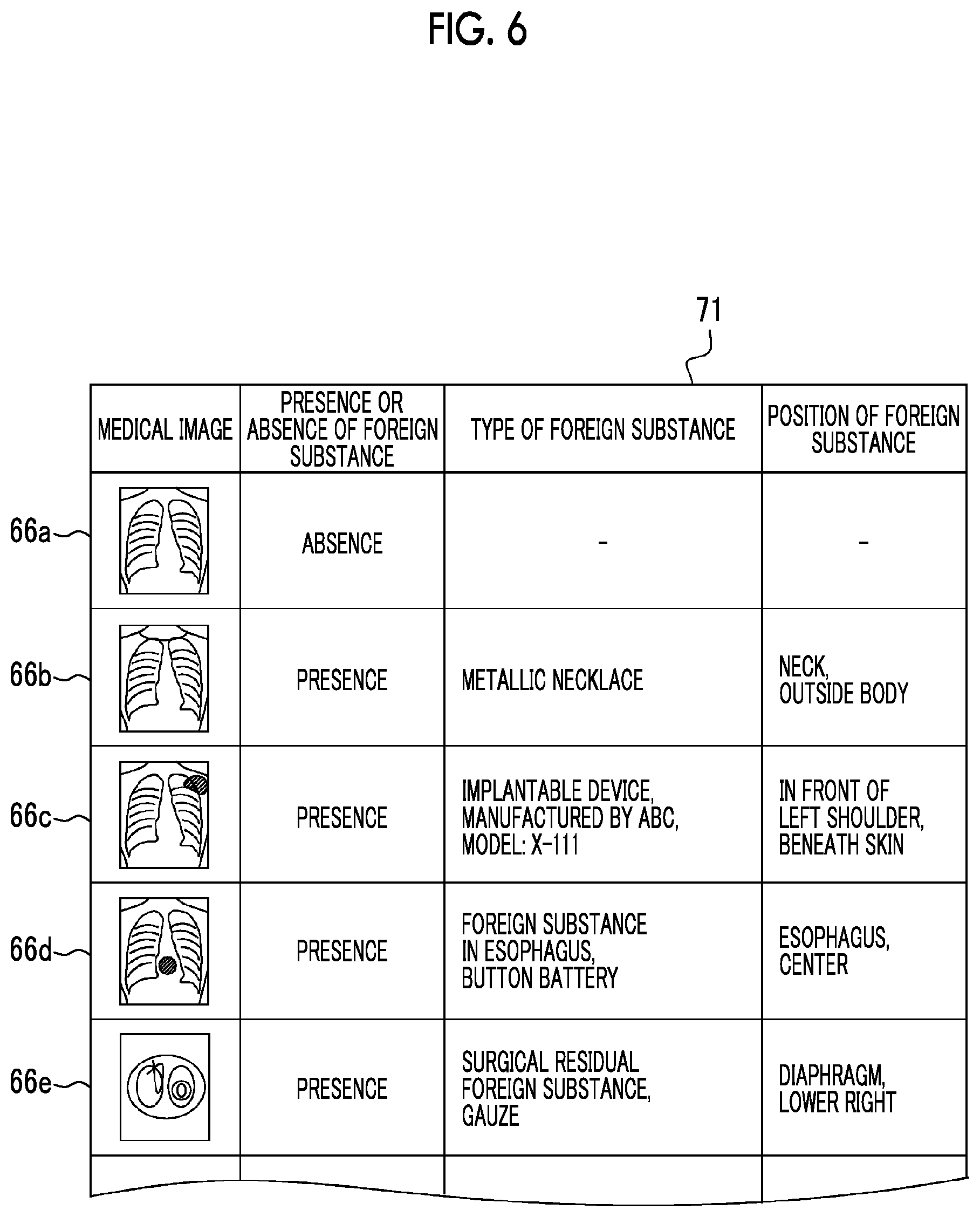 Patent US12112476 Figure 6 – Medical support device, operation method of medical support device, non-transitory computer readable medium, and medical support system
