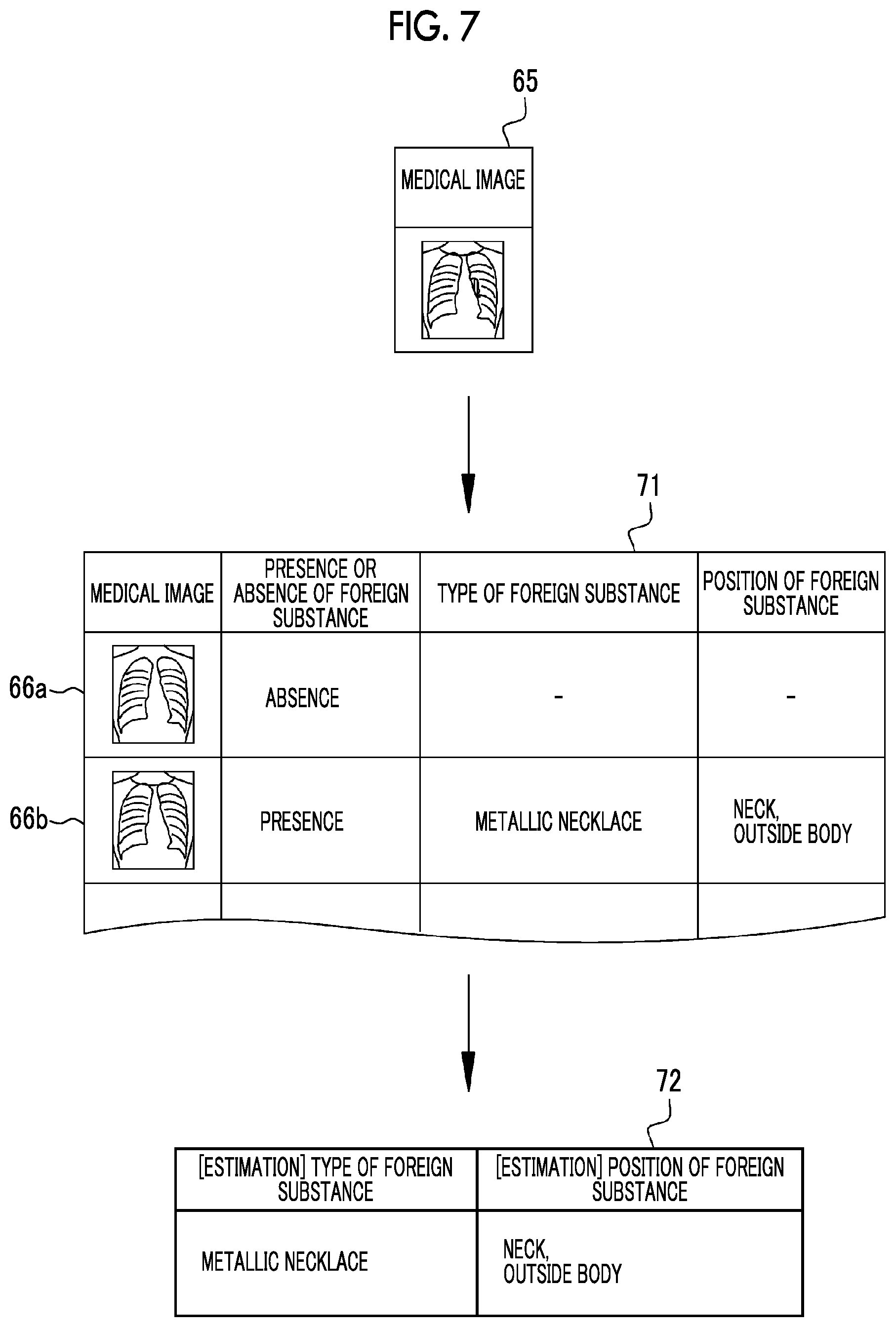 Patent US12112476 Figure 7 – Medical support device, operation method of medical support device, non-transitory computer readable medium, and medical support system