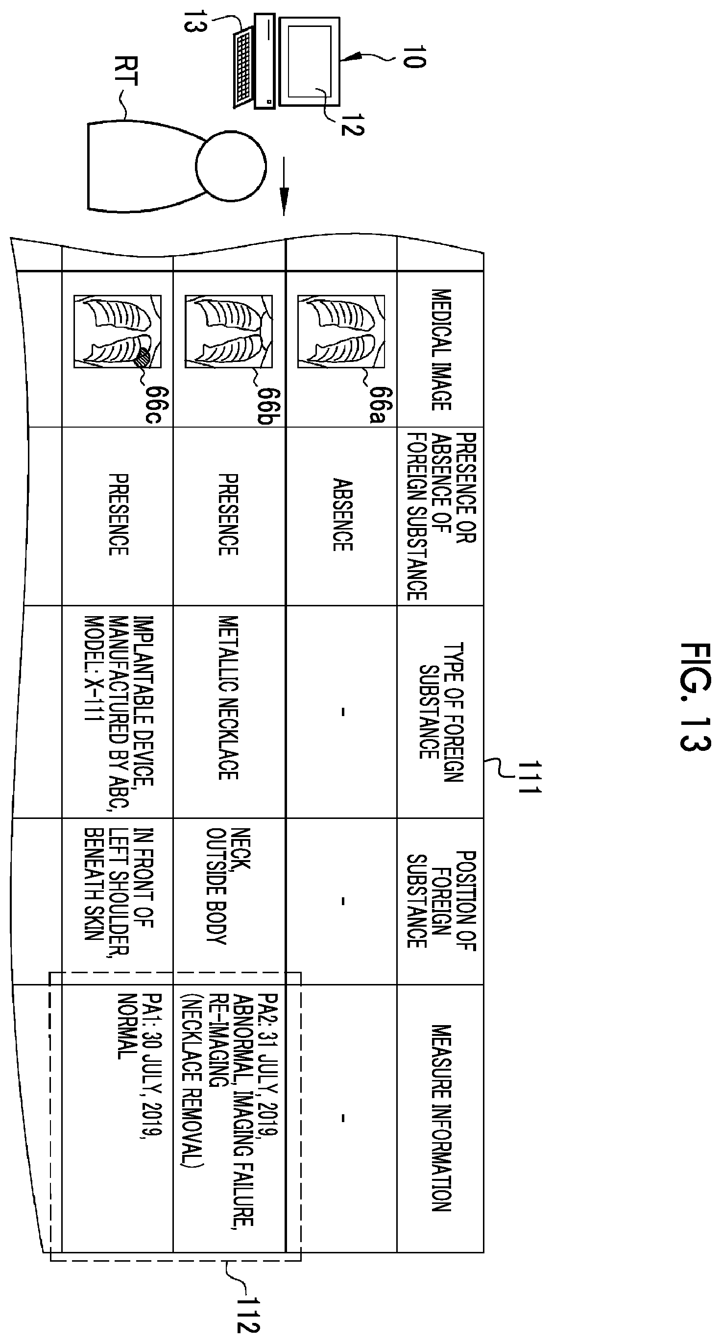 Patent US12112476 Figure 13 – Medical support device, operation method of medical support device, non-transitory computer readable medium, and medical support system
