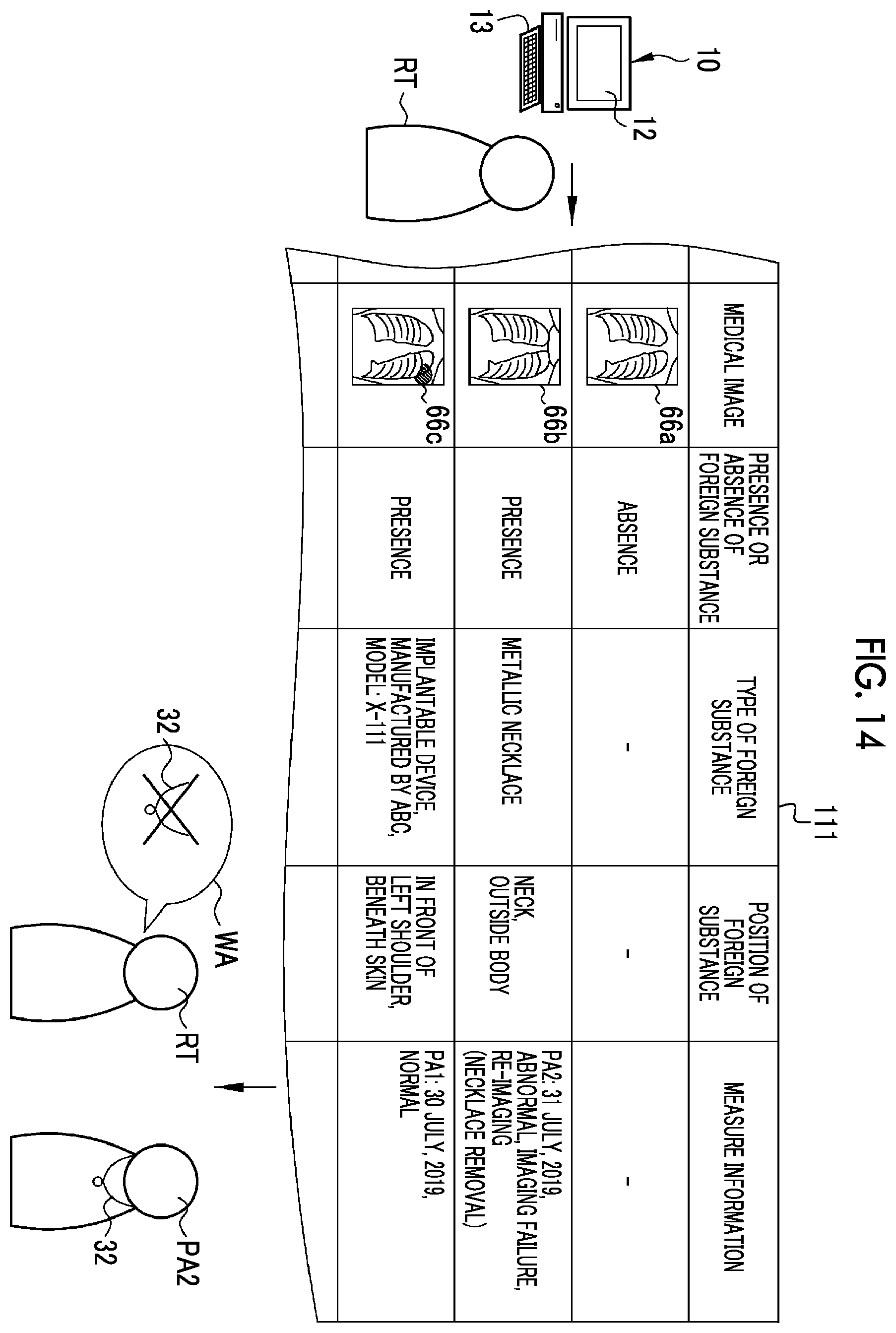 Patent US12112476 Figure 14 – Medical support device, operation method of medical support device, non-transitory computer readable medium, and medical support system