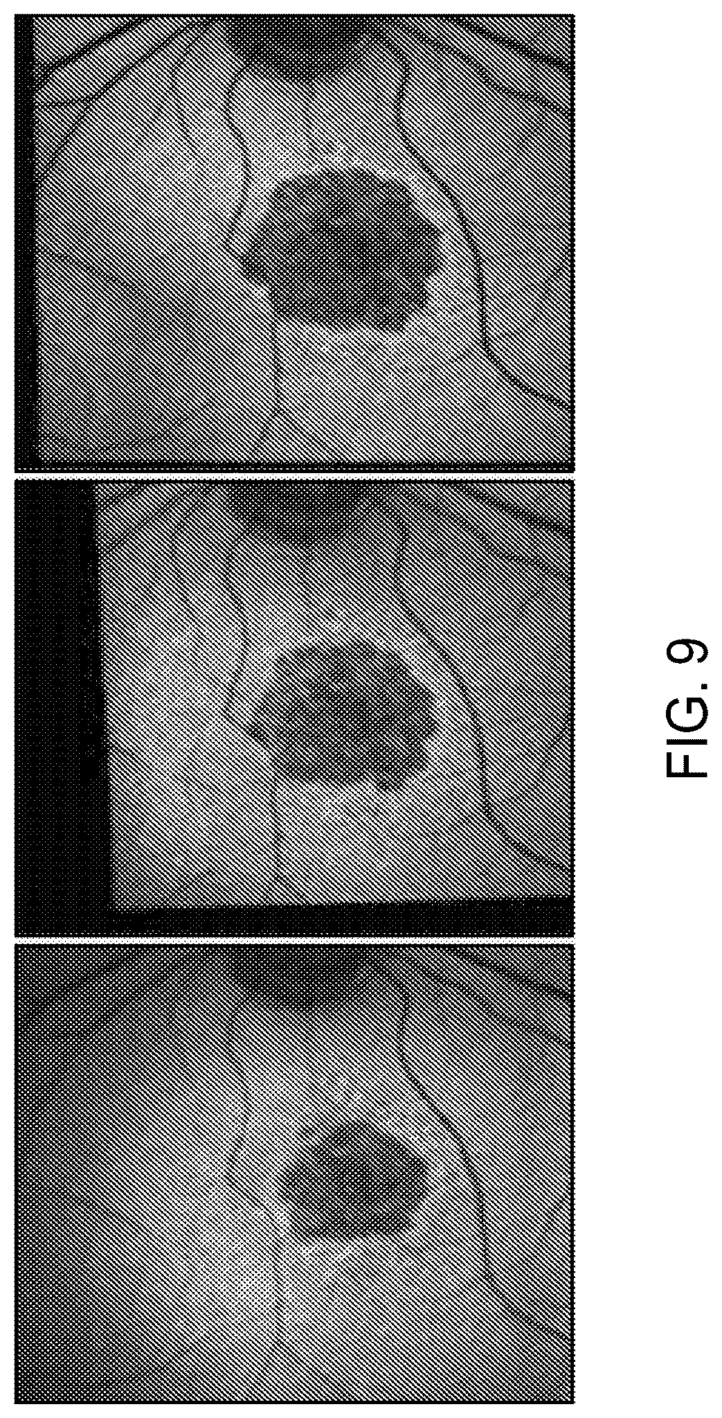 Patent US12112480 Figure 9 – Systems and methods for processing, storage and retrieval of ocular images