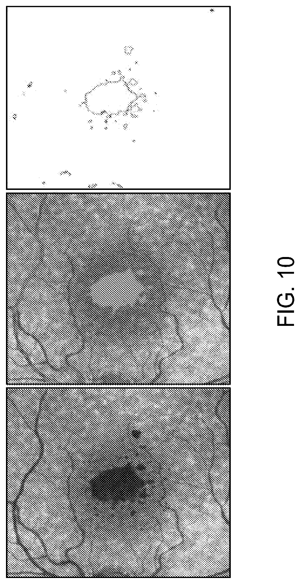 Patent US12112480 Figure 10 – Systems and methods for processing, storage and retrieval of ocular images