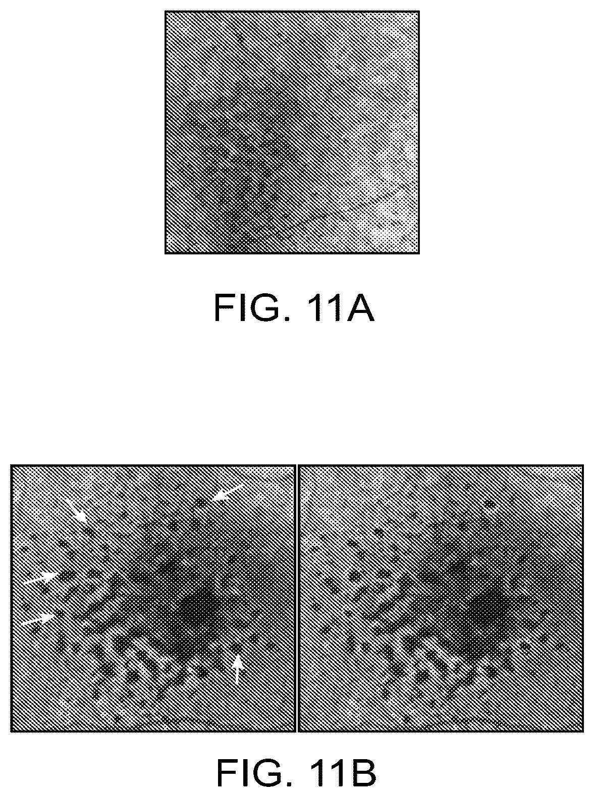 Patent US12112480 Figure 11 – Systems and methods for processing, storage and retrieval of ocular images