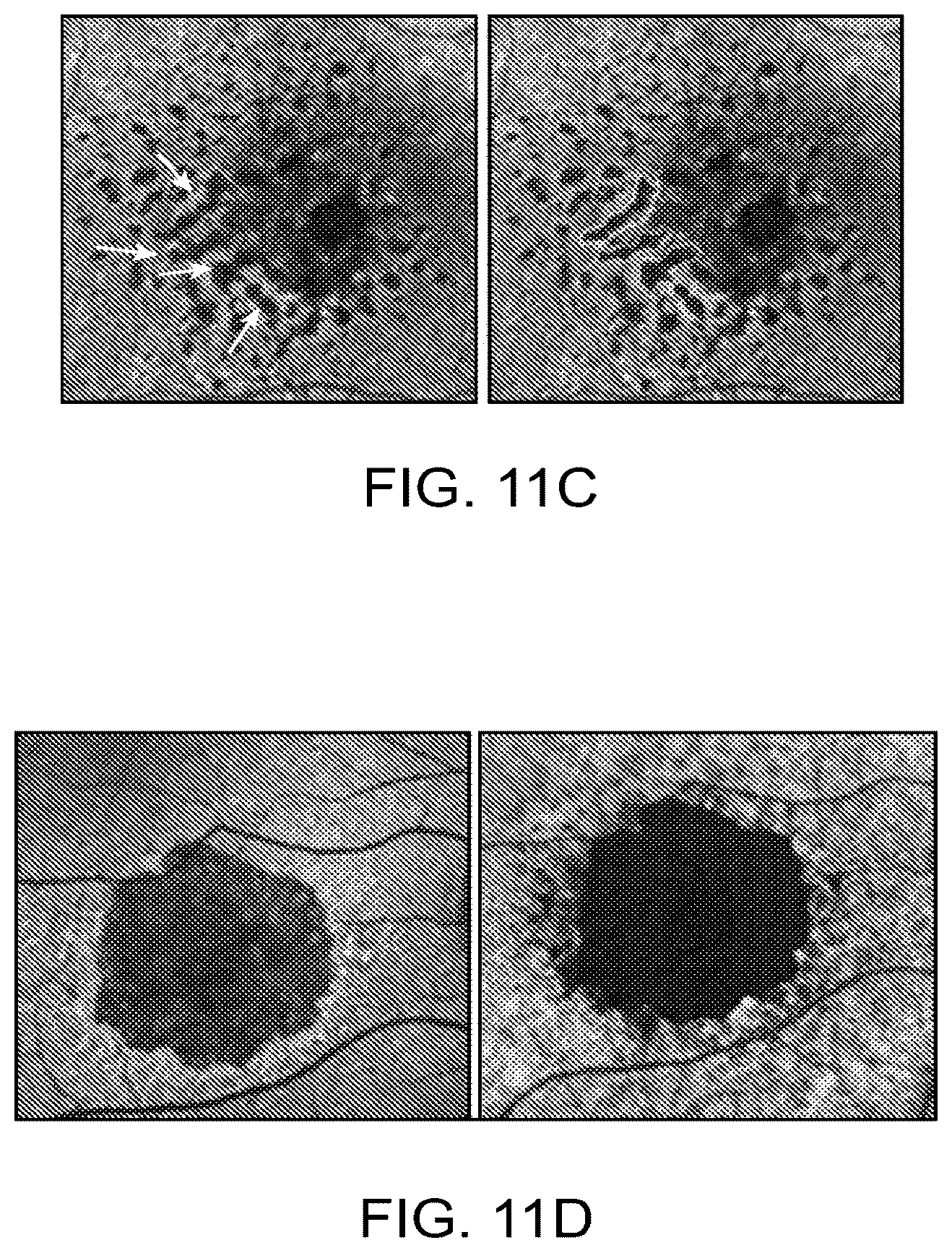 Patent US12112480 Figure 12 – Systems and methods for processing, storage and retrieval of ocular images