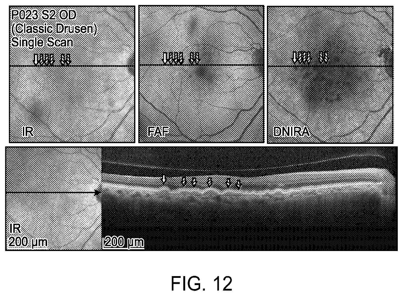 Patent US12112480 Figure 13 – Systems and methods for processing, storage and retrieval of ocular images