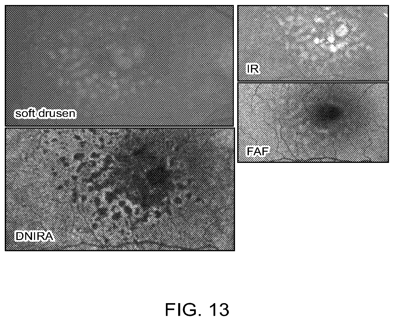 Patent US12112480 Figure 14 – Systems and methods for processing, storage and retrieval of ocular images