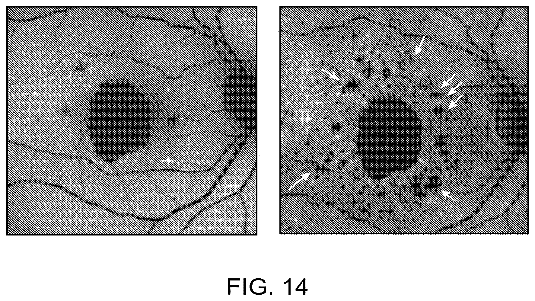 Patent US12112480 Figure 15 – Systems and methods for processing, storage and retrieval of ocular images