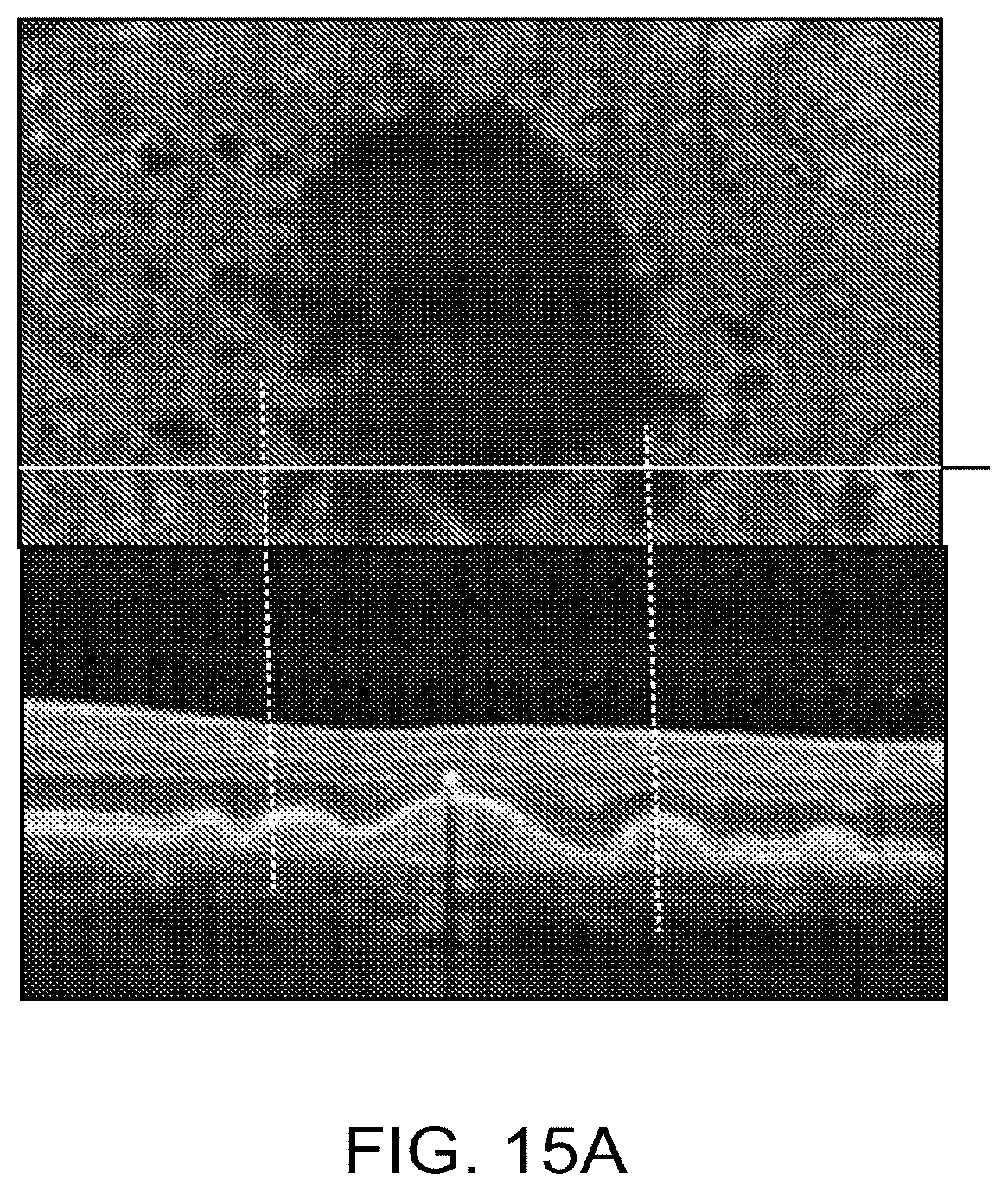 Patent US12112480 Figure 16 – Systems and methods for processing, storage and retrieval of ocular images