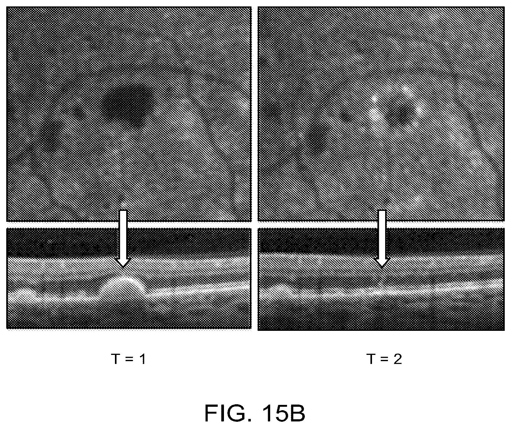 Patent US12112480 Figure 17 – Systems and methods for processing, storage and retrieval of ocular images