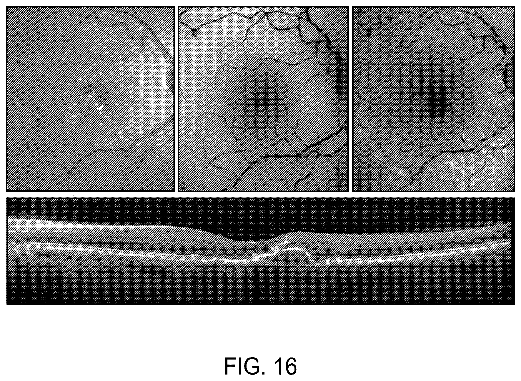 Patent US12112480 Figure 18 – Systems and methods for processing, storage and retrieval of ocular images