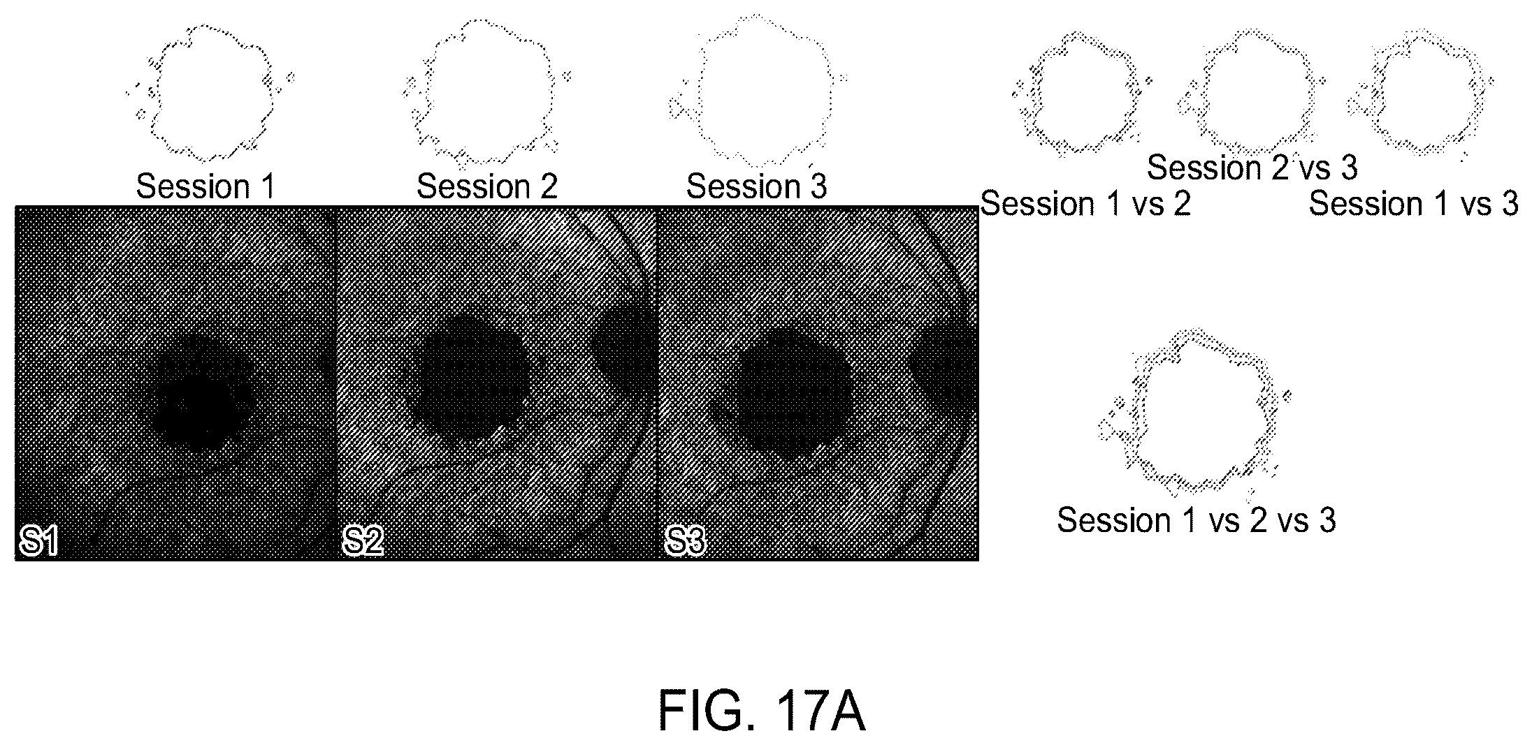 Patent US12112480 Figure 19 – Systems and methods for processing, storage and retrieval of ocular images