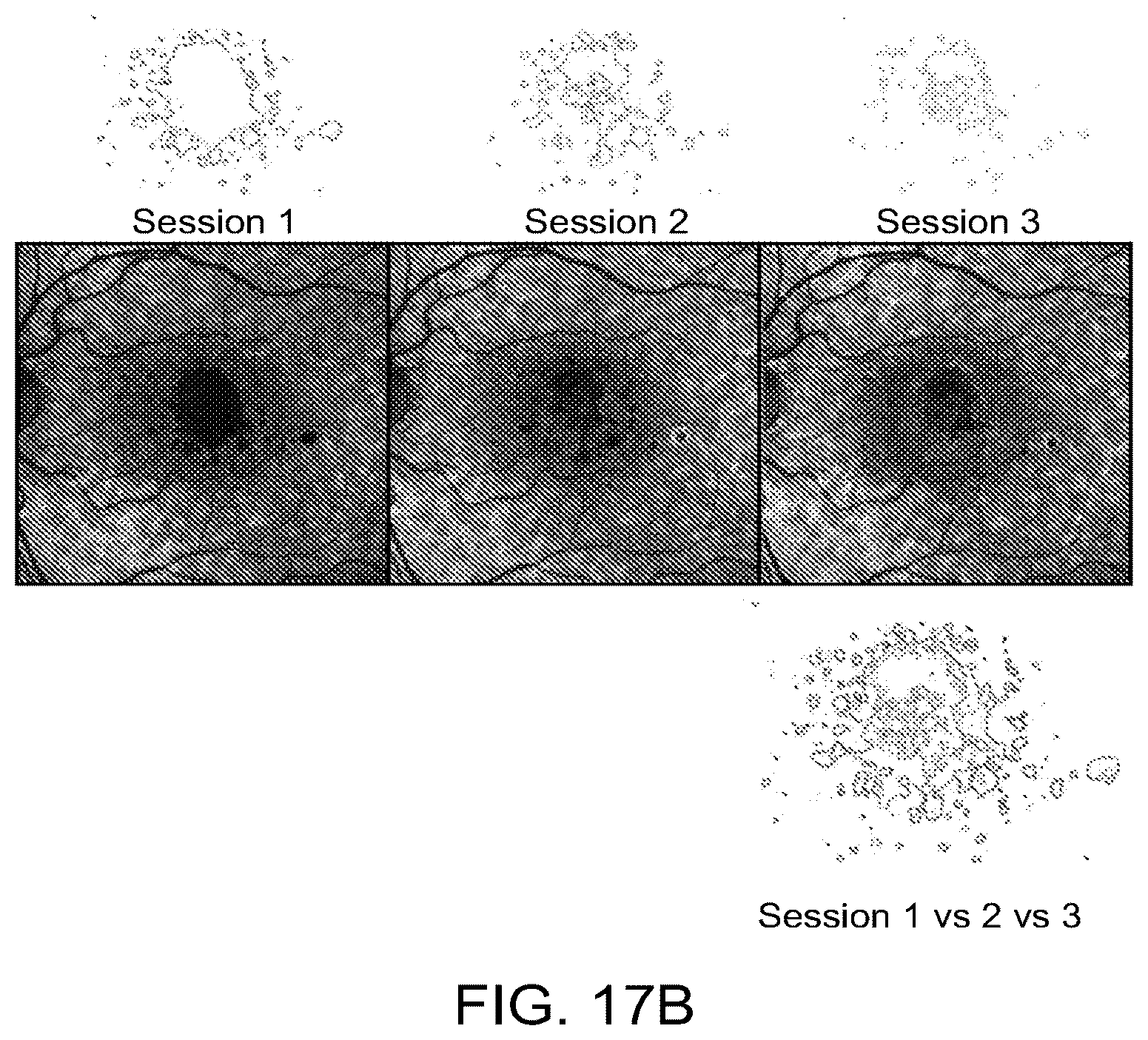 Patent US12112480 Figure 20 – Systems and methods for processing, storage and retrieval of ocular images