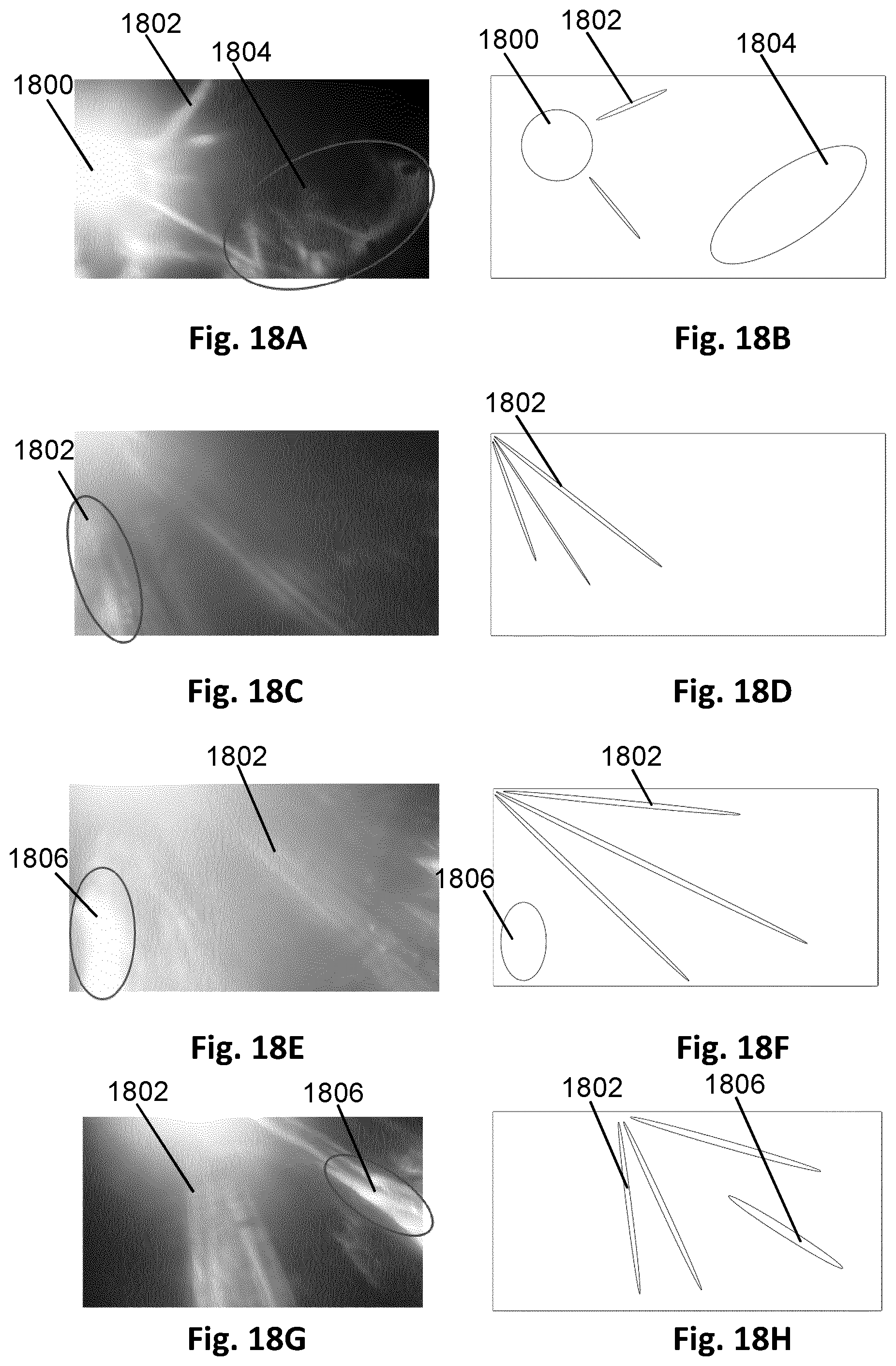 Patent US12112505 Figure 11 – System and method for determining whether a camera component is damaged