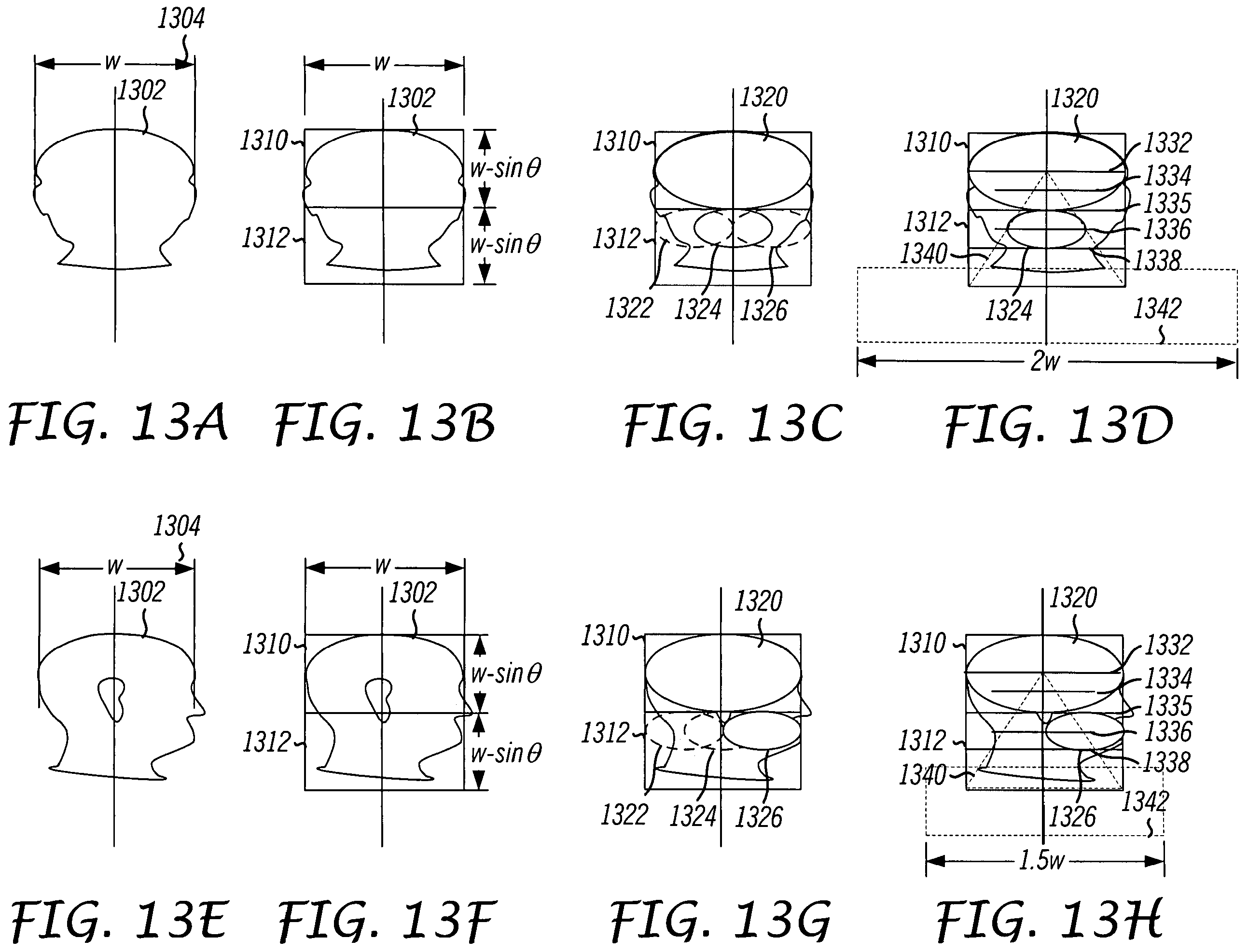 Patent US12112566 Figure 15 – System and method for using a video monitoring system to prevent and manage decubitus ulcers in patients